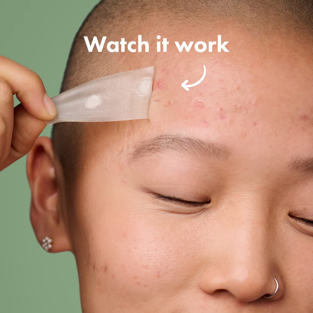 Mighty Patch™ Surface patch from Hero Cosmetics - Hydrocolloid Spot Patch for Body Mighty Patch buy supplements canada