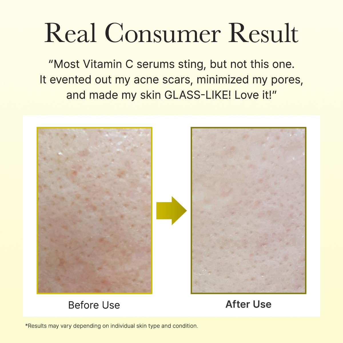 Arencia Vitamin C Booster Shot Serum with Glutathione, Niacinamide and Vitamin E for Dark Spot Care, Fine Lines & Wrinkles ARENCIA buy supplements canada