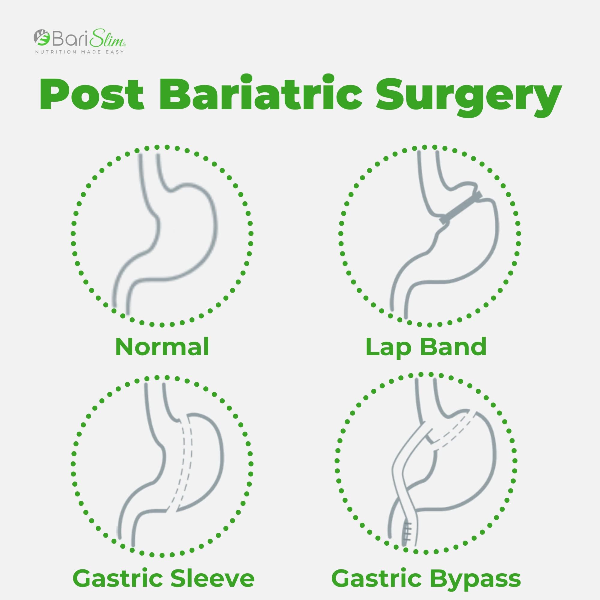 BariSlim Bariatric Calcium Citrate Plus Powder - Formulated for Patients After Weight Loss BariSlim buy supplements canada