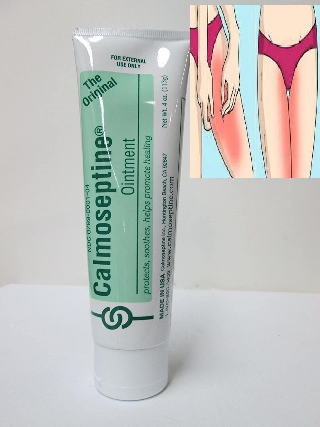 Crema para Infecciones Vaginales Elimina hongos Picazon Irritación Pomada Vagina Generic buy supplements canada
