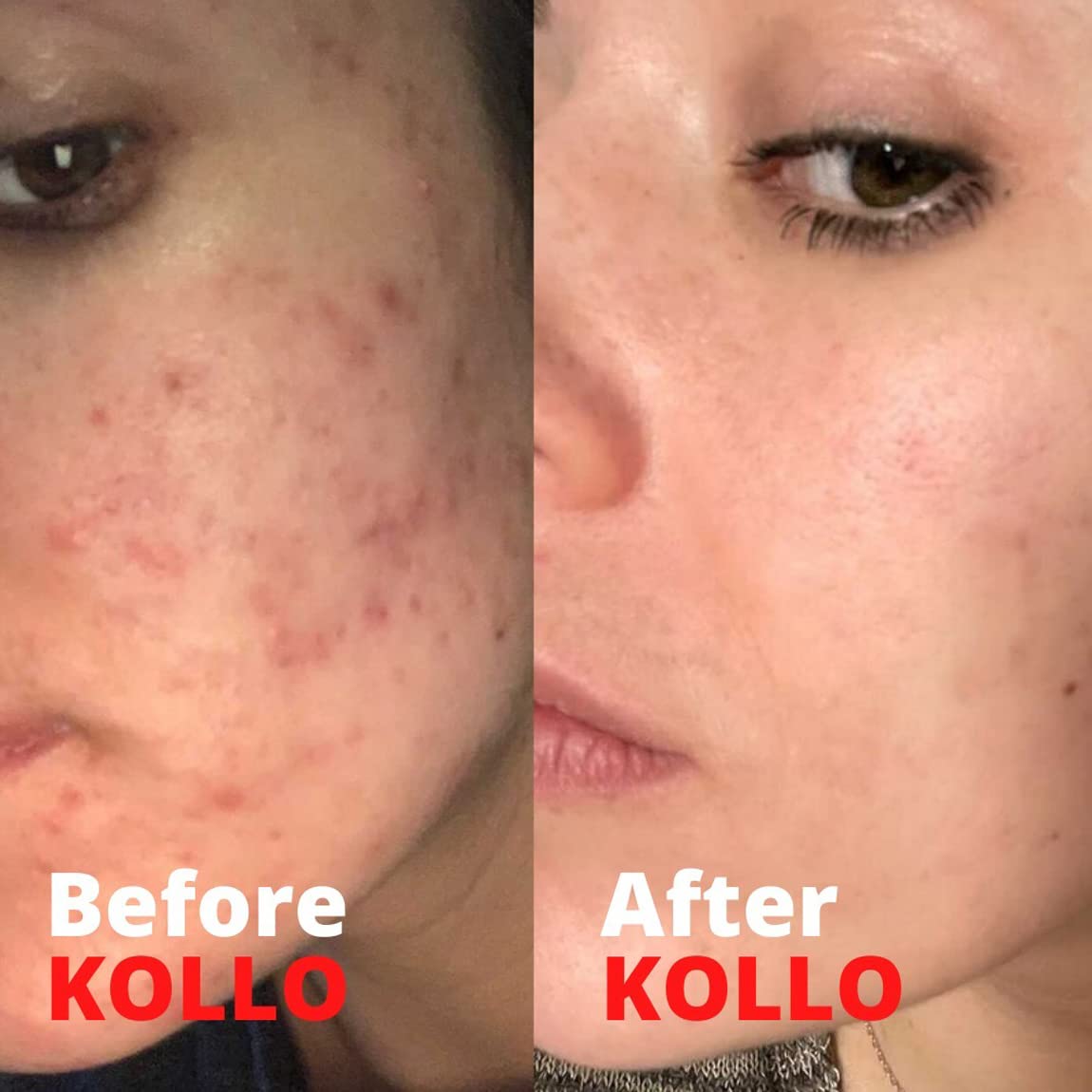 Kollo Premium Marine Collagen Liquid, 10,000 mg - Essential Proteins Collagen Peptides Kollo buy supplements canada