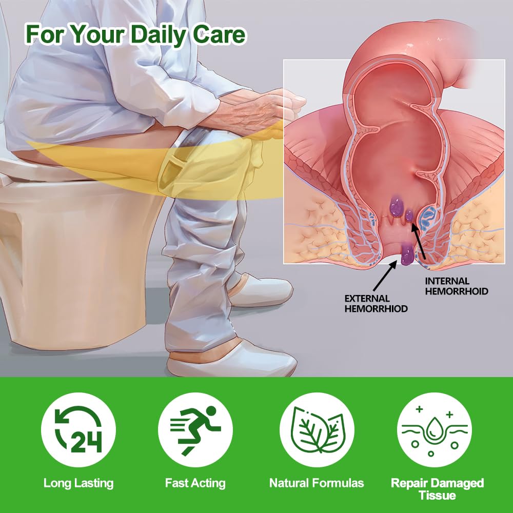 RHAICARE Hemorrhoid and Fissure Cream,Hemorrhoidal Ointment for Fast Acting Itch, Swelling, and Maximum Strength Pain Relief（1 Pack RHAICARE buy supplements canada