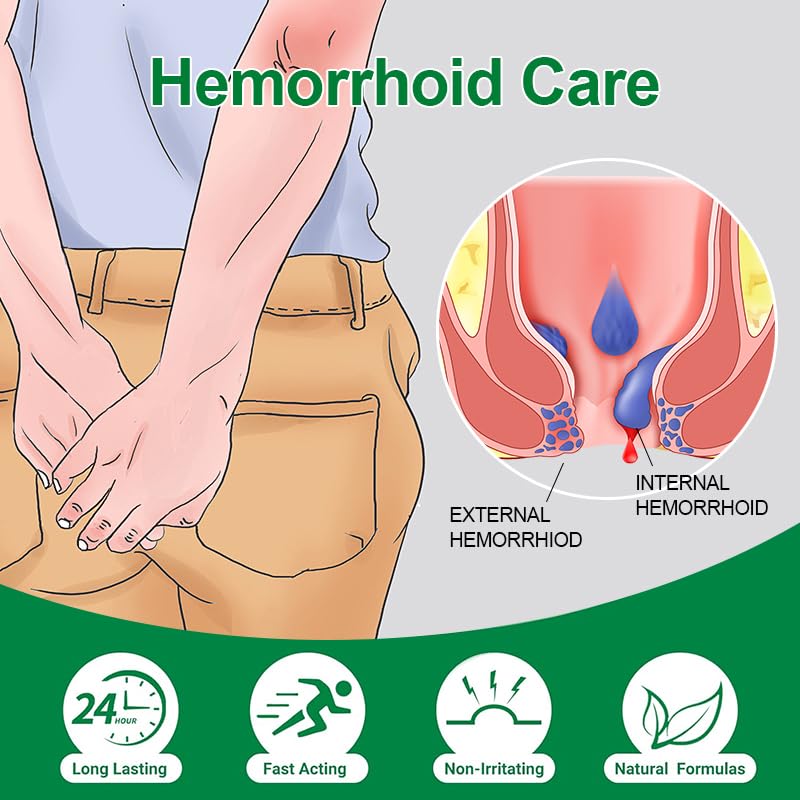 vamy Hemorrhoid Ointment (2 x 20g Tubes), 40g - Maximum Strength Formula for Hemorrhoidal Fast Relief, Soothes Itching, Burning & Discomfort vamy buy supplements canada