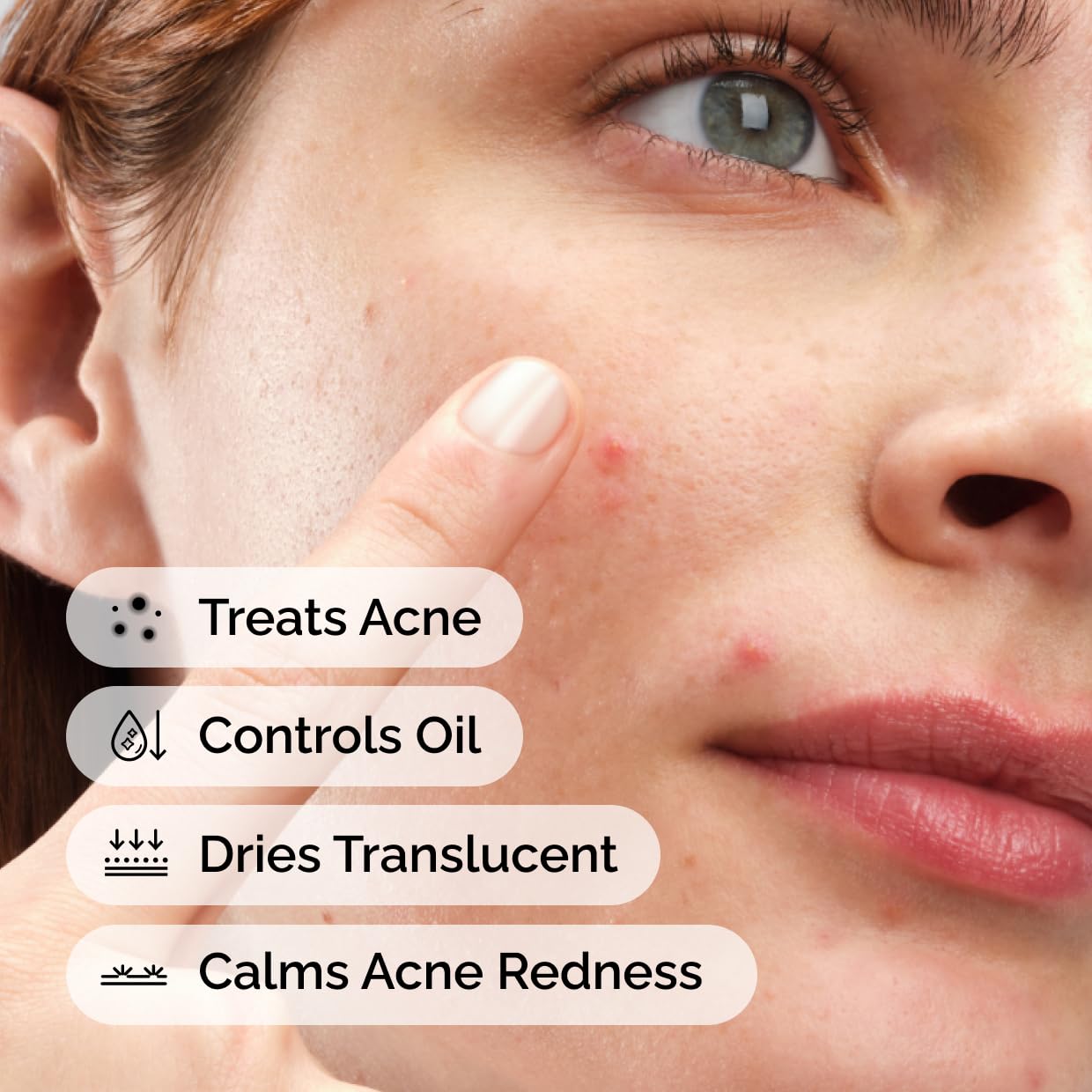 The Ordinary Sulfur 10% Powder-to-Cream Acne Spot Treatment Concentrate, Reduces Pimple Size and Zit Redness, 0.18 Oz The Ordinary buy supplements canada