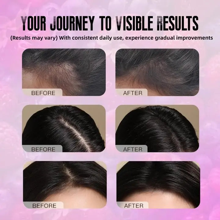 BDQBDQ Lumin Hair Growth Gummies, Infused with Biotin, Vitamins, and Botanical Extracts to Support Healthy Hair Growth and Strength BDQBDQ buy supplements canada