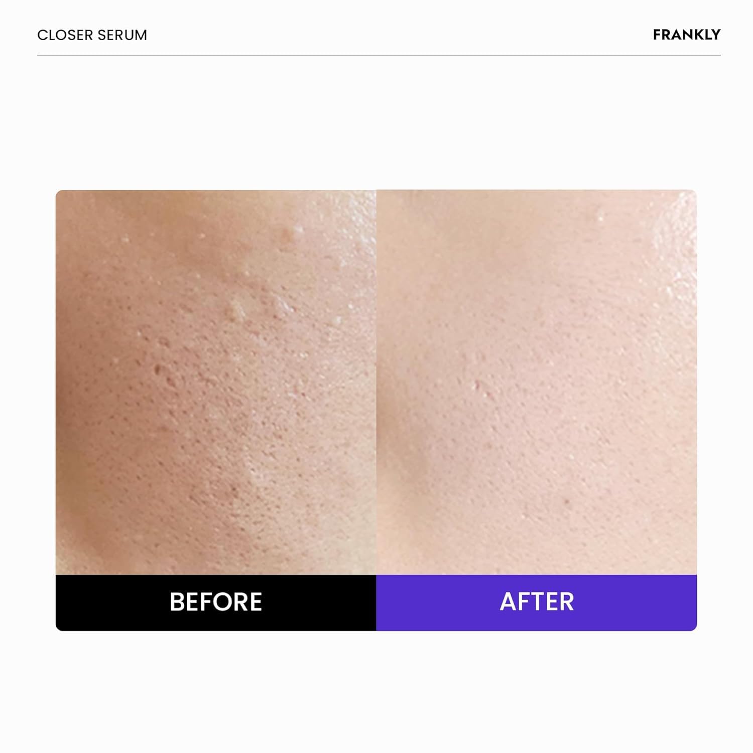 FRANKLY Closer Serum | Pore Minimizer Serum | 9 Peptides, Vegan Collagen, Adenosine, PHA | Korean Pore Minimizer for Glass Skin FRANKLY buy supplements canada