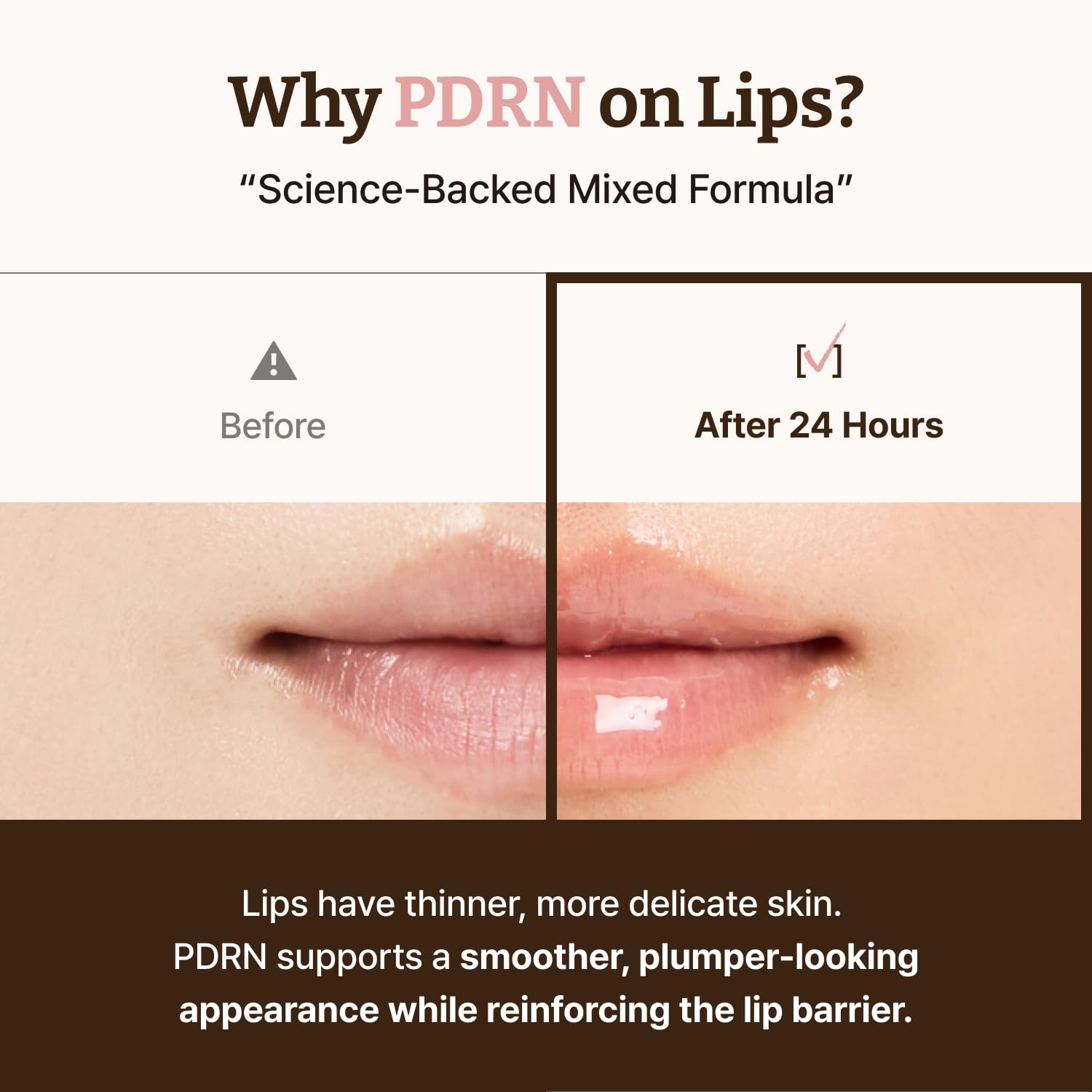 Dr. Reju-All Advanced PDRN Rejuvenating Lip Serum – Hydrating Lip Balm with Lipozip PDRN for Glowy, Dewy Lips Dr.Reju-All buy supplements canada