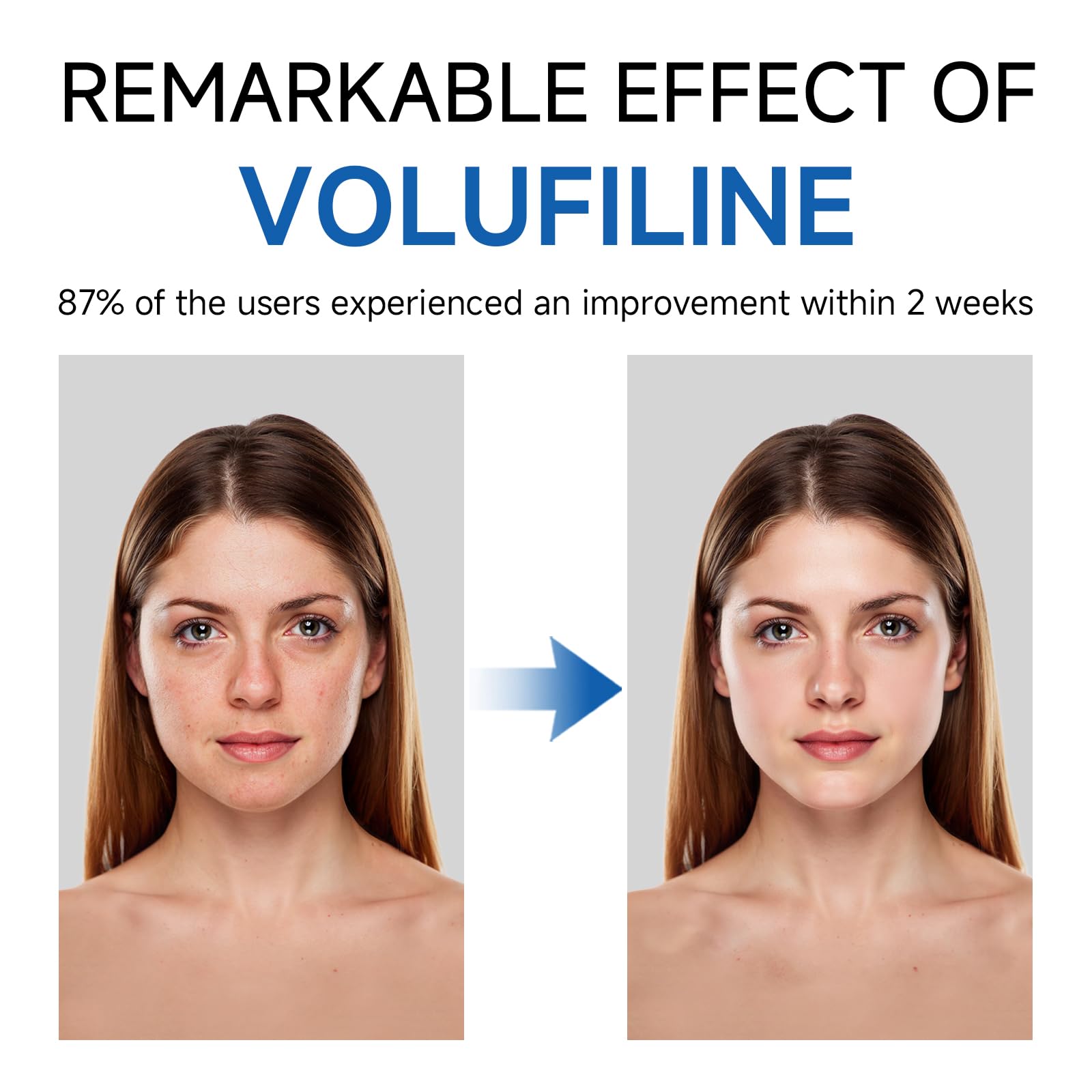 Volufiline Serum, Volufiline Under Eye Serum, Cosmetic Grade Ampoule for Skin Elasticity Improvement, Face & Body Fine Lines, Hydrating Texture, 10ml*2 GUDE GUDE buy supplements canada