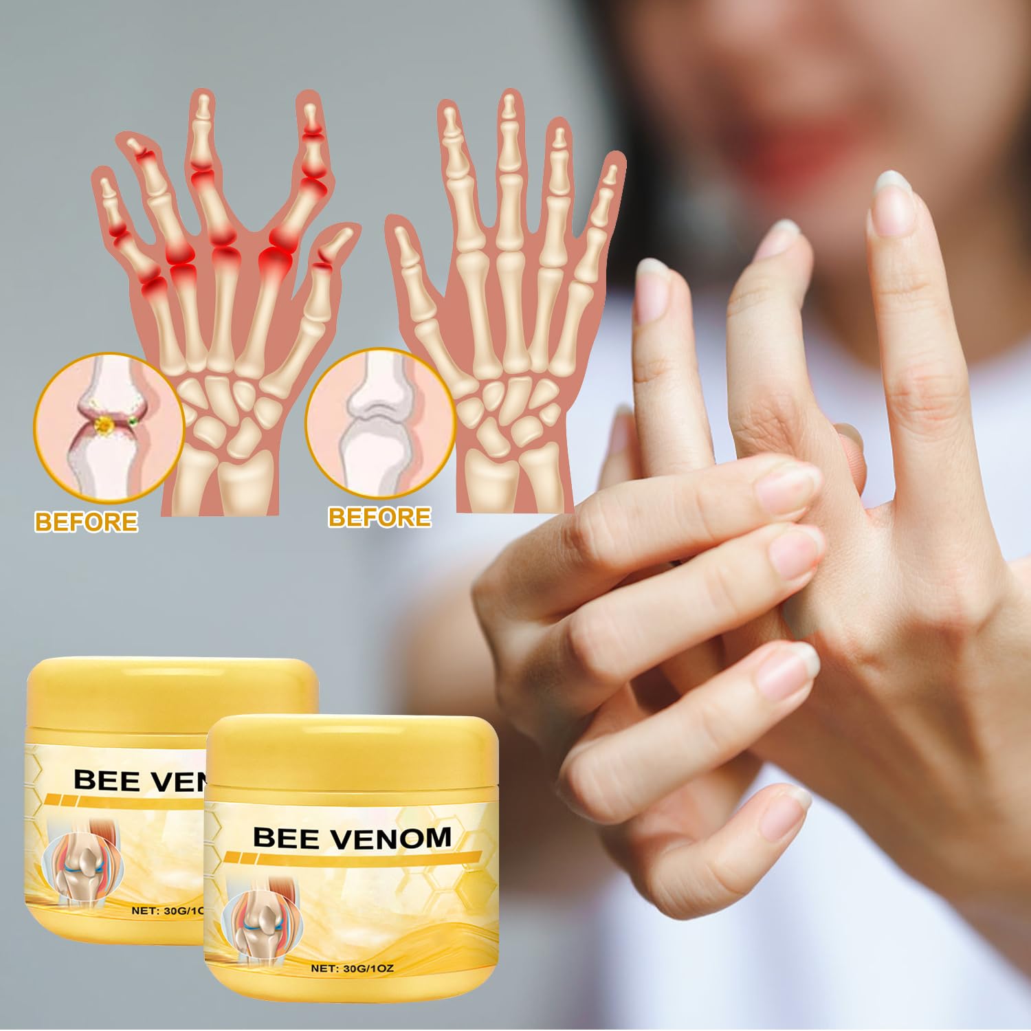 Botou 2PCS New Bee Venom Professional Joint Cream, for Neck, Waist, Back, Hands, Feet and Legs Advanced Bee Propolis Joint Cream, yellow Botou buy supplements canada