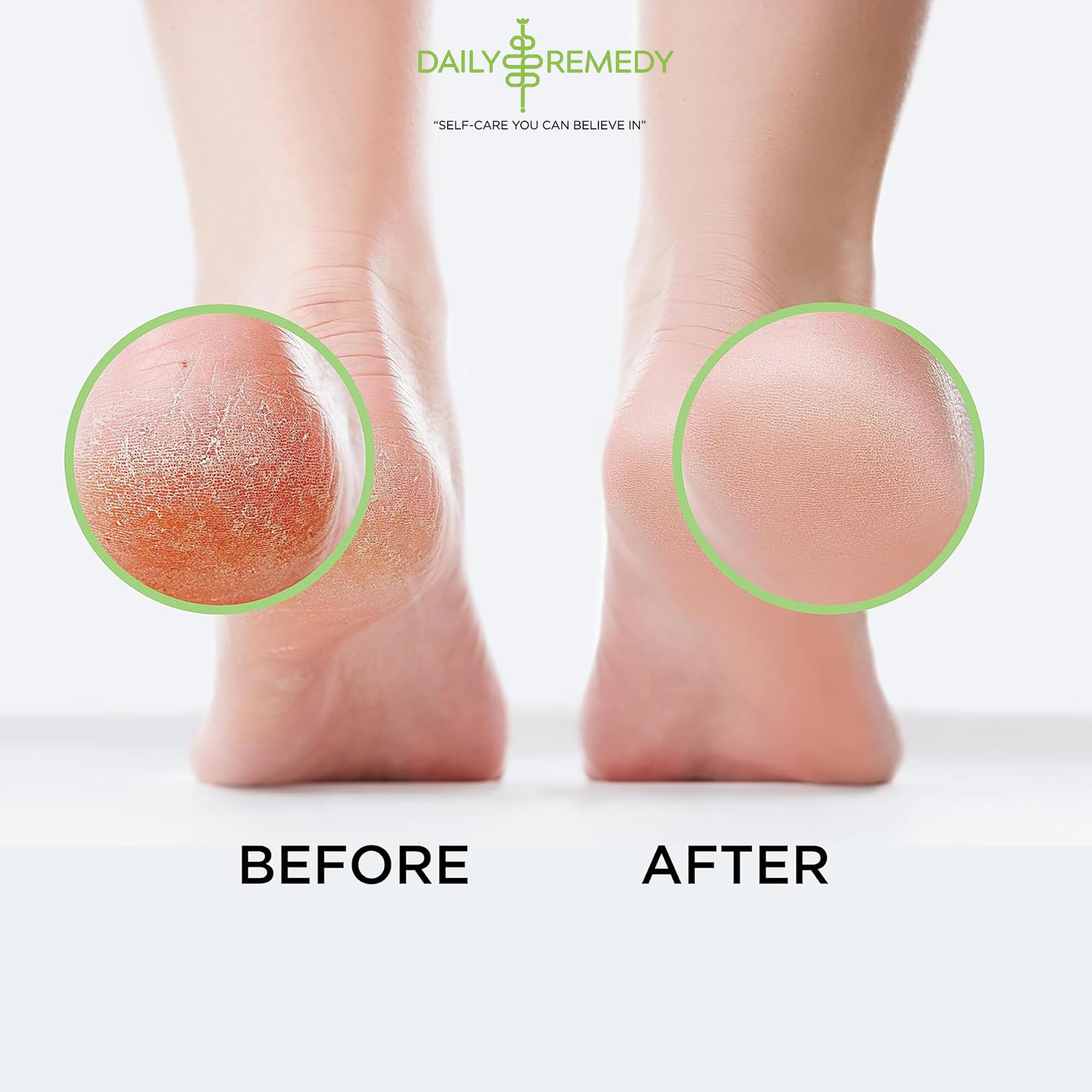 Tea Tree Oil Foot Soak with Epsom Salt - Made in USA - for Toenail Athletes Foot DAILY REMEDY buy supplements canada