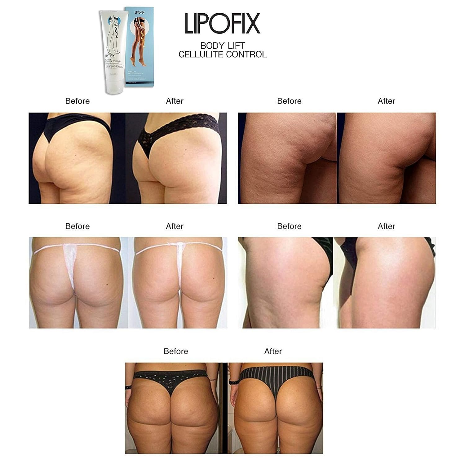 LIPOFIX Anti Cellulite Cream Luxurious Formula Body Contour Cream Effectively Tone LIPOFIX buy supplements canada