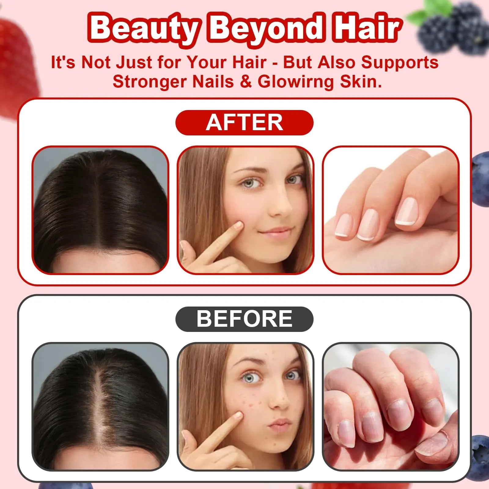 LUIMOLL Lumin Hair Growth Gummies – Daily Hair Nourishment with Biotin, Collagen & Botanical Extracts – Supports Thicker, Stronger & Healthier-Looking Hair LUIMOLL buy supplements canada