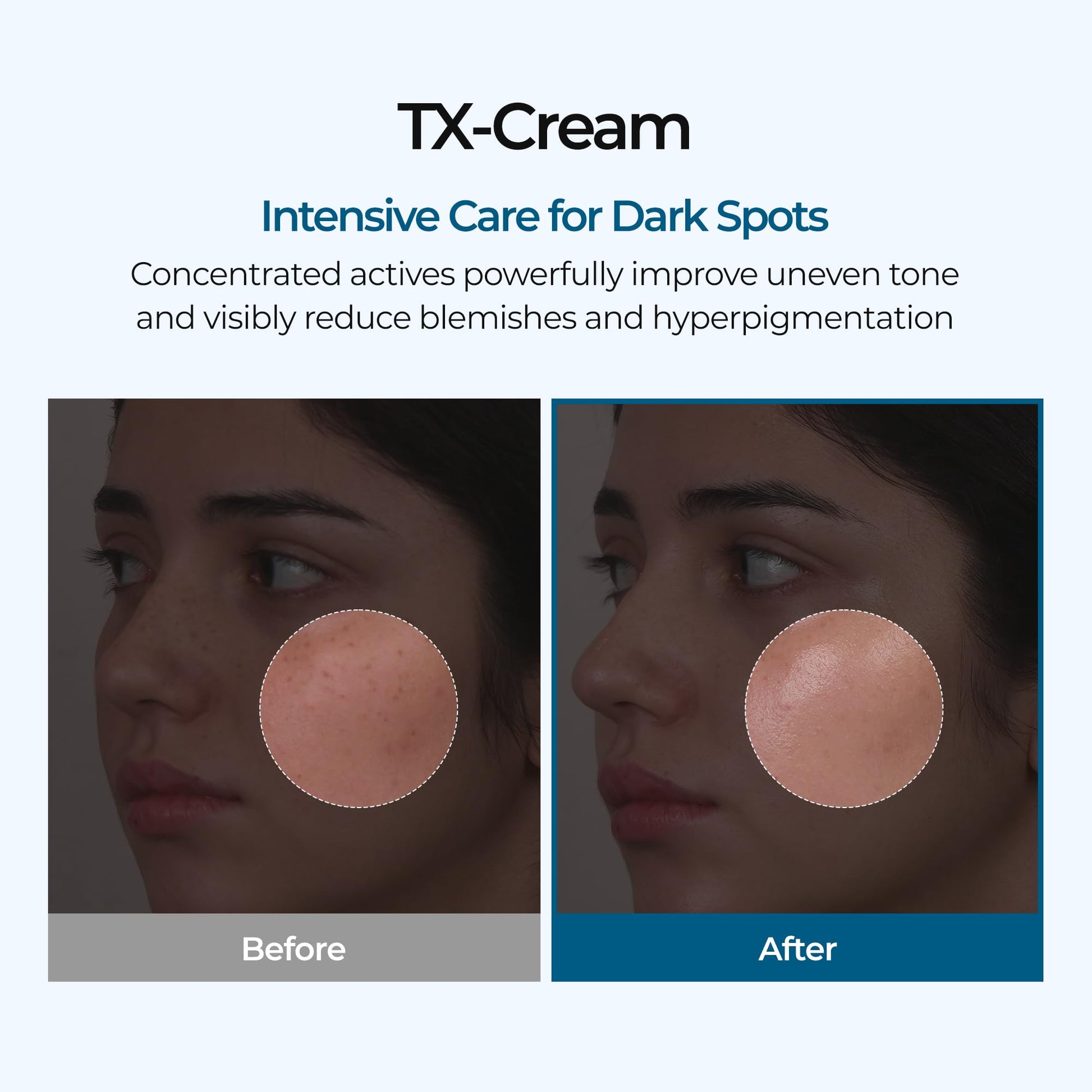 DR.Melaxin TX Tranexamic Acid CREAM | Skin freckle Cream, Blemishes, Anti-pigmetation korean skin care Dr.Melaxin buy supplements canada