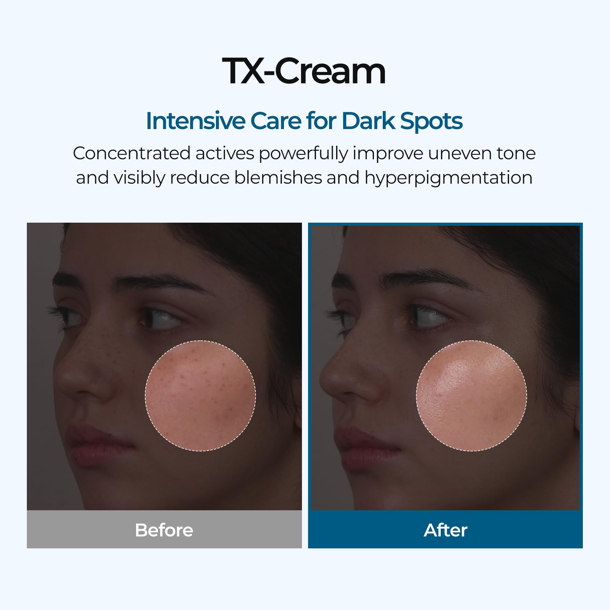 DR.Melaxin TX Tranexamic Acid CREAM | Skin freckle Cream, Blemishes, Anti-pigmetation korean skin care Dr.Melaxin buy supplements canada