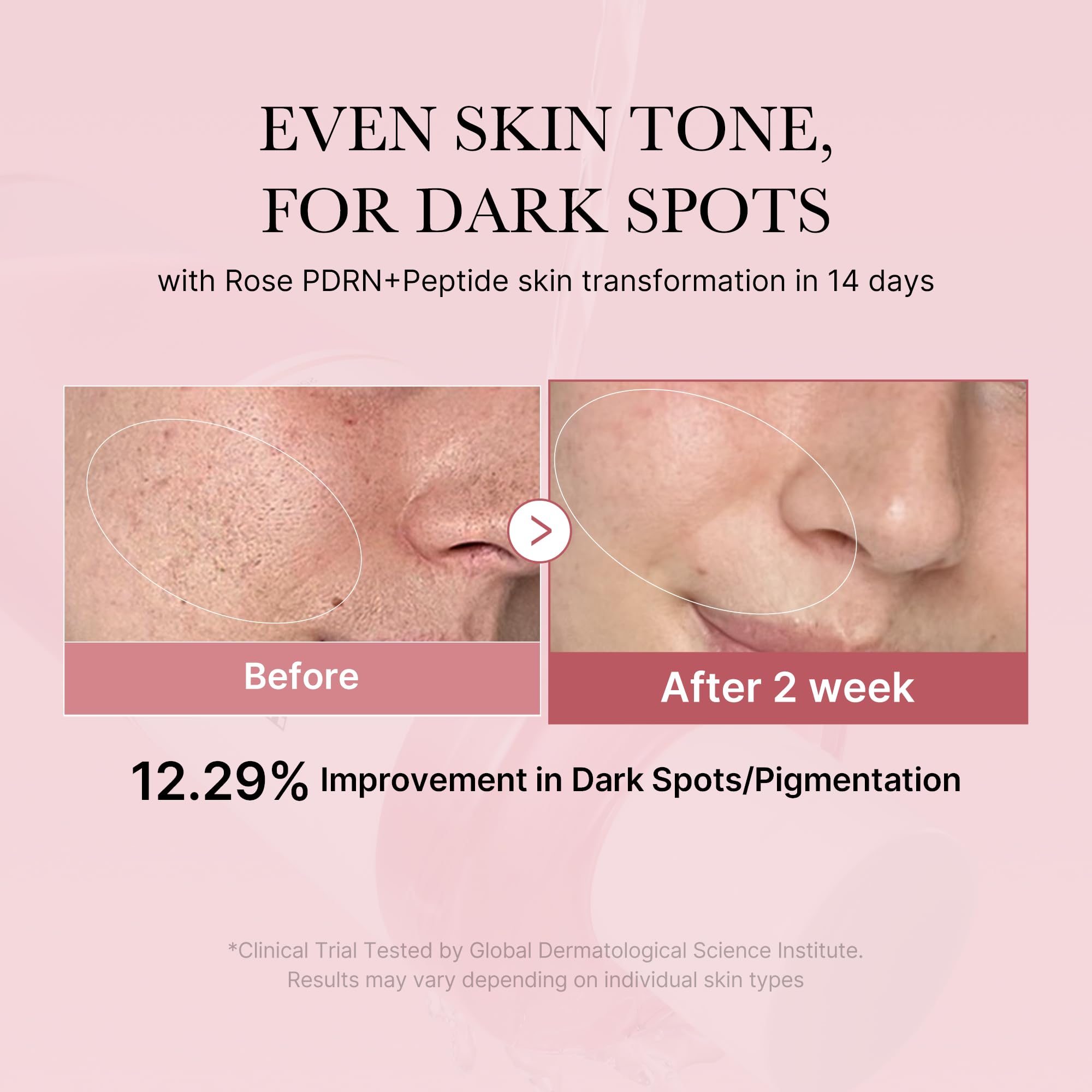 medicube PDRN Toner Rose PDRN Peptide Toner | Lightweight & Watery Type for Skin Boosting, Soothing and Calming, Uneven Skin Tone | with Rose, Peptide, Niacinamide | Korean Skincare, 8.45 fl.oz medicube buy supplements canada