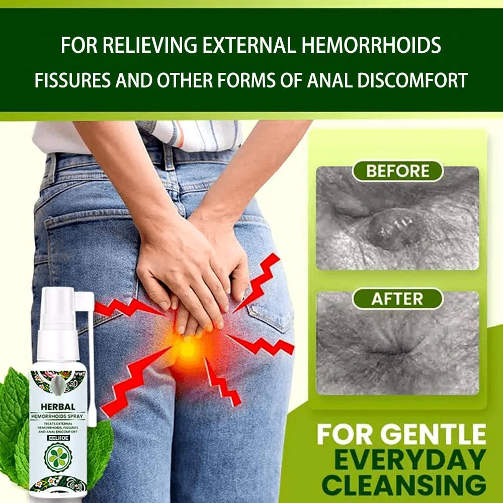 Juztec Hemorrhoid Treatment - Fast Relief with Hemocare Herbal Hemorrhoids Spray & Analese Numb Cream (1 PCS) Juztec buy supplements canada
