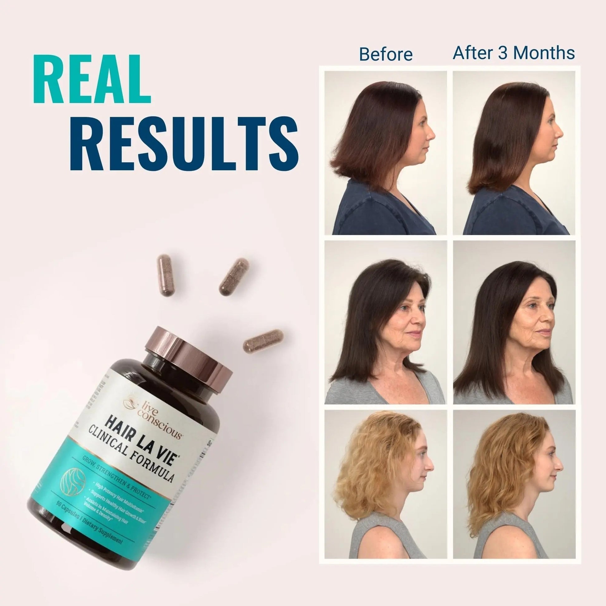 Hair La Vie Live Conscious Clinical Formula Hair Growth Vitamins for Women and Men w/Biotin, Collagen & Saw Palmetto (Pack of 1) Hair La Vie buy supplements canada