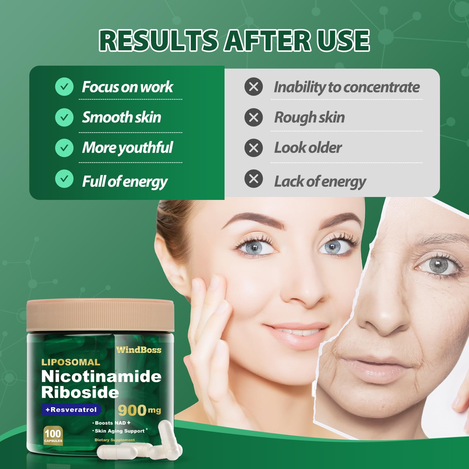 Windboss Liposomal NAD+ Supplement with Nicotinamide Riboside & Resveratrol, NAD Booster for Cellular Energy, Anti-Aging & Metabolism – NMN Alternative, NAD Supplement for Men & Women – 2pcs Windboss buy supplements canada