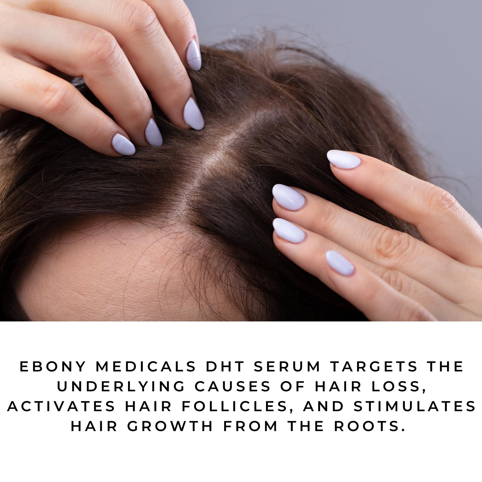 Ebony Medicals DHT Blocker Hair Growth Serum - Hair Loss Supplement, Supports Natural Regrowth Natural Curves buy supplements canada
