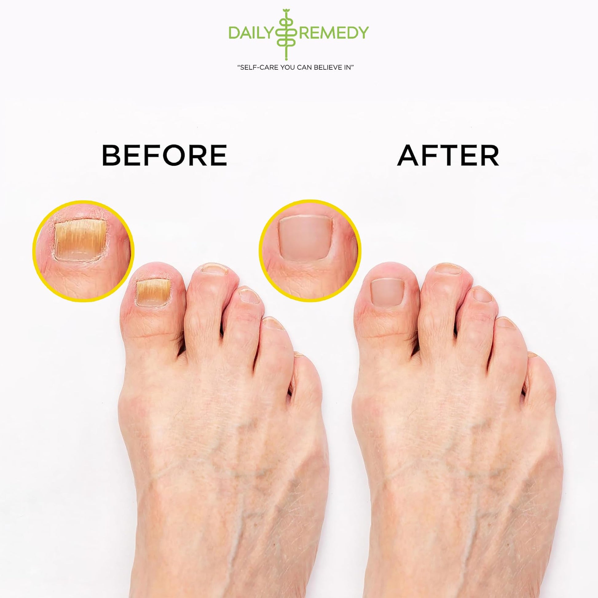Citrus Detox Foot Soak with Epsom Salt - for Foot Callus, Immune Boost, Damaged Toenail DAILY REMEDY buy supplements canada