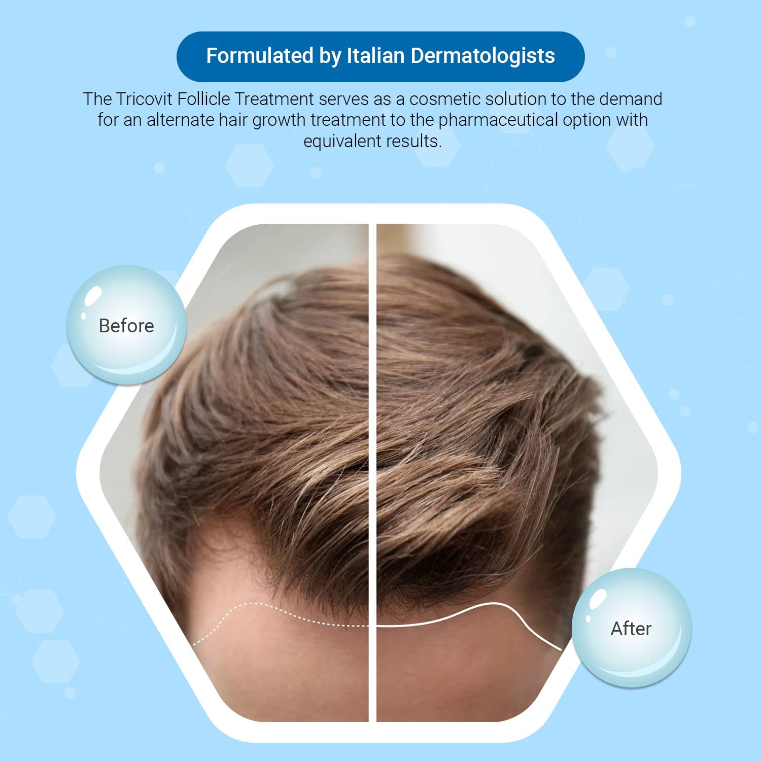 Tricovit Hair Growth Supplement - Nail & Hair Health Vitamins with Amino Acids, Minerals & Antioxidants - Dermatologist-Formulated & Gluten-Free Vitamins and Supplements for Women & Men (60 tablets) Tricovit buy supplements canada