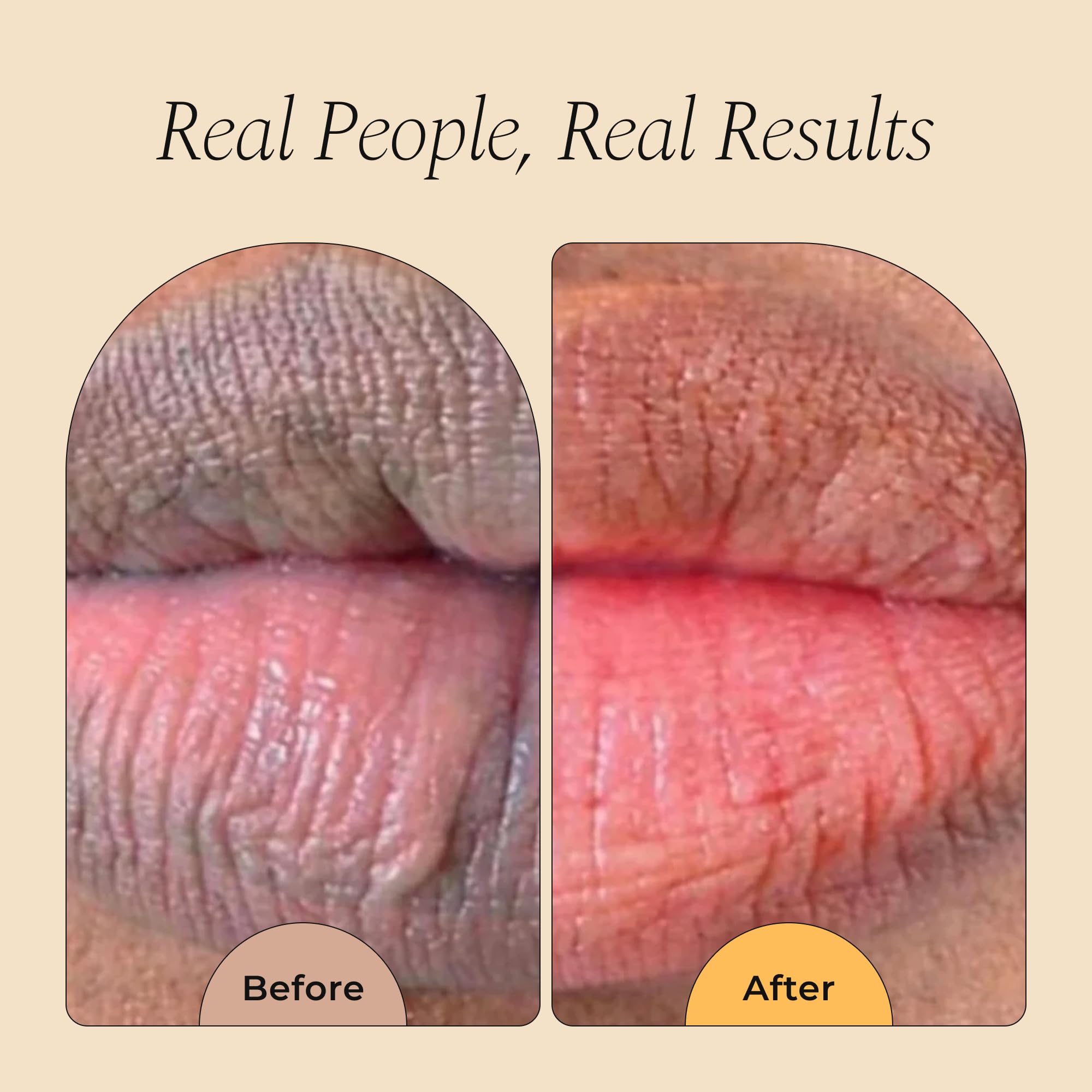 Glo Melanin All Natural Lemon and Turmeric Lip Balm - Natural Lip Balm Illuminate Your Smile Glo Melanin buy supplements canada