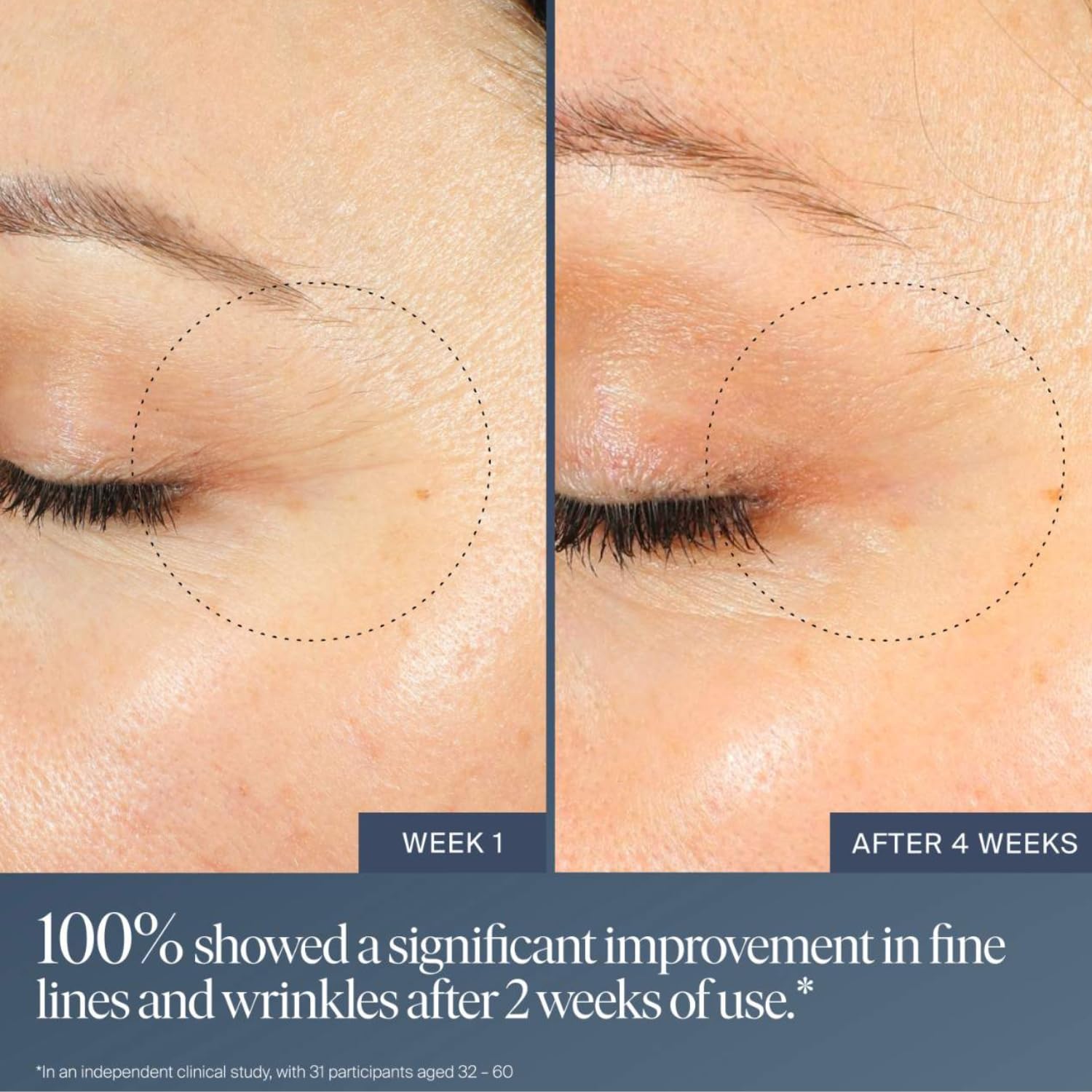 Summer Fridays Jet Lag Overnight Eye Serum - Nourishing Undereye Treatment for Dark Circles - Helps to Hydrate, Smooth, Firm & Depuff - Enriched with Glycerin to Lock in Moisture (0.5 Fl Oz) Summer Fridays buy supplements canada