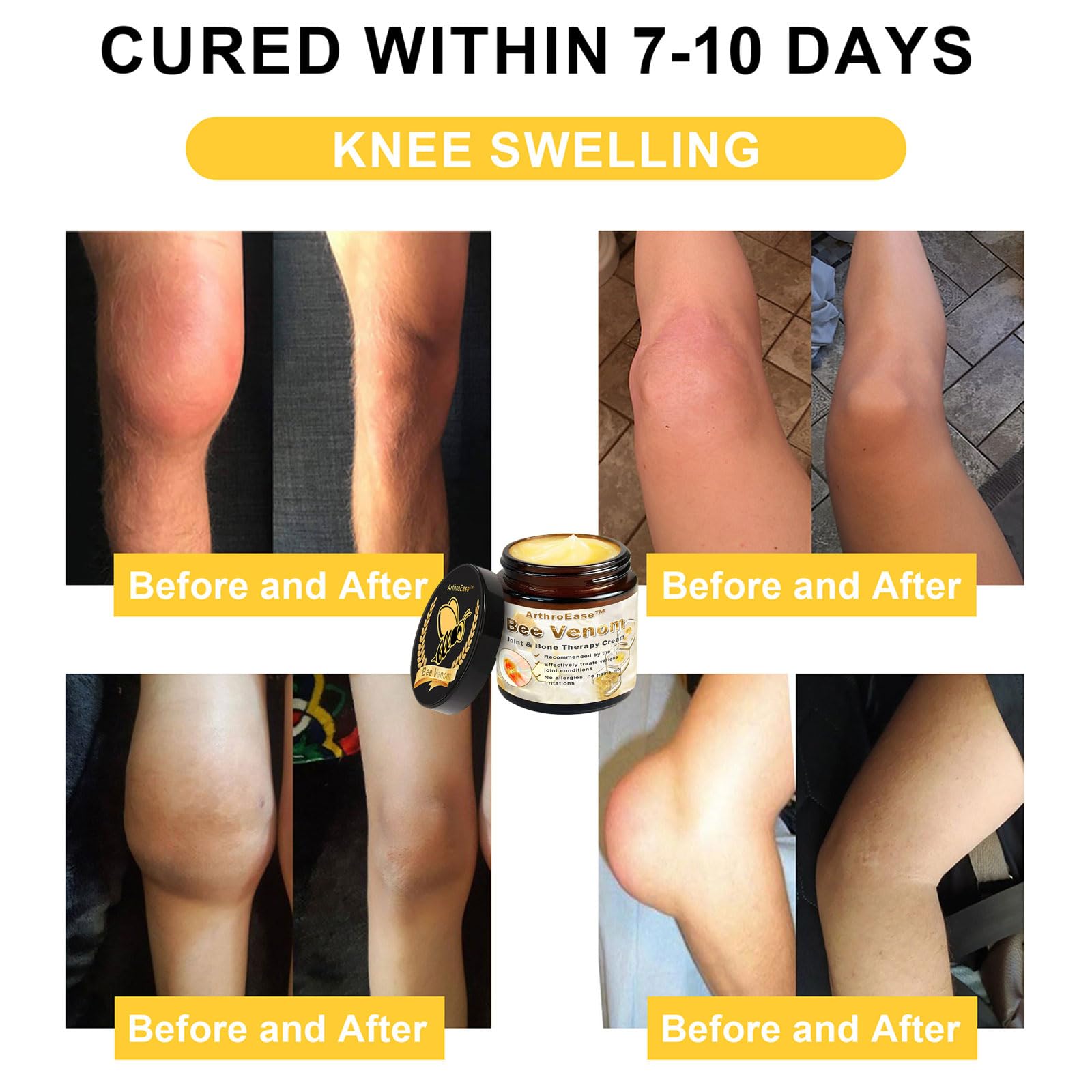 ArthroEase Bee Venom Joint and Bone Cream,ArthroEase Bee Venom Cream,Bee Venom Joint Gel,Effectively Relieve Joint discomfort (2) ADFIRE buy supplements canada