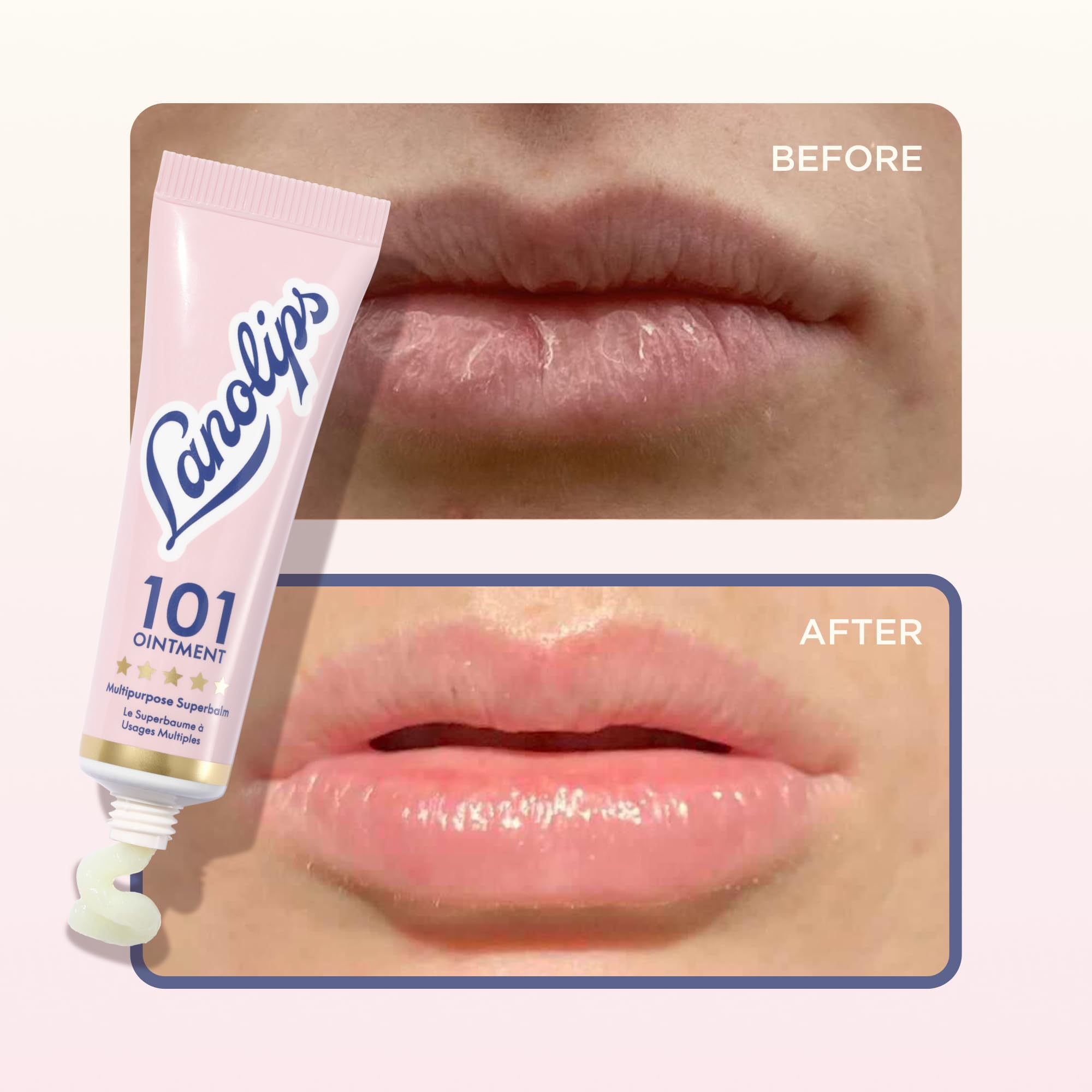 Lanolin 101 Multipurpose Ointment - Lanolin Lip Balm & Healing Ointment for Skin Barrier Repair - Moisturizer for Dry Lips, Cuticles & Elbows - No Petroleum Formula - Original Superbalm (0.52 oz) Lanolips buy supplements canada
