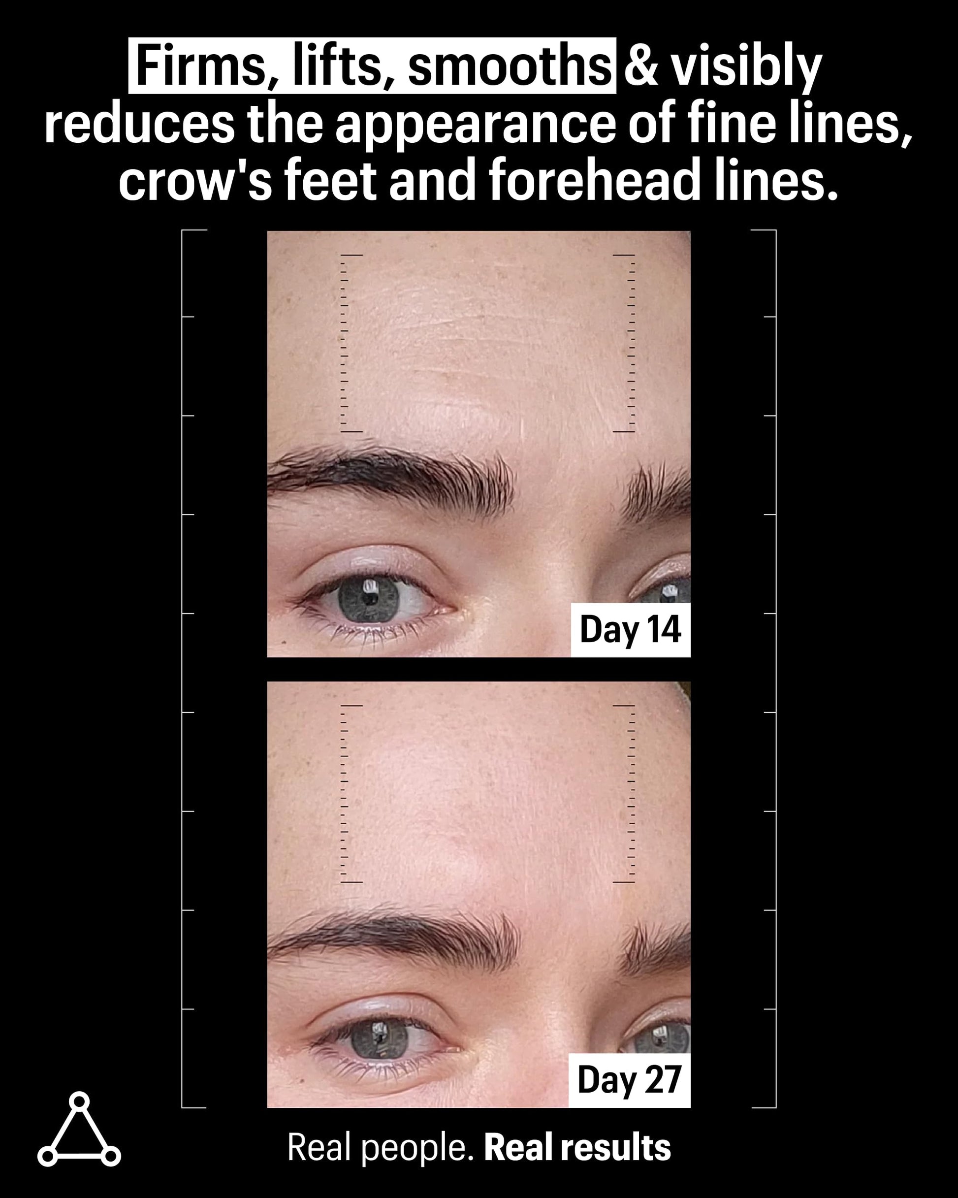 Allies of Skin Multi Peptides & Growth Factor Collagen Boosting Face Serum | Skin Tightening Anti-Aging Complex with 9% Peptides| Firms Sagging Skin & Visibly Reduces Wrinkles (1 oz) Allies of Skin buy supplements canada