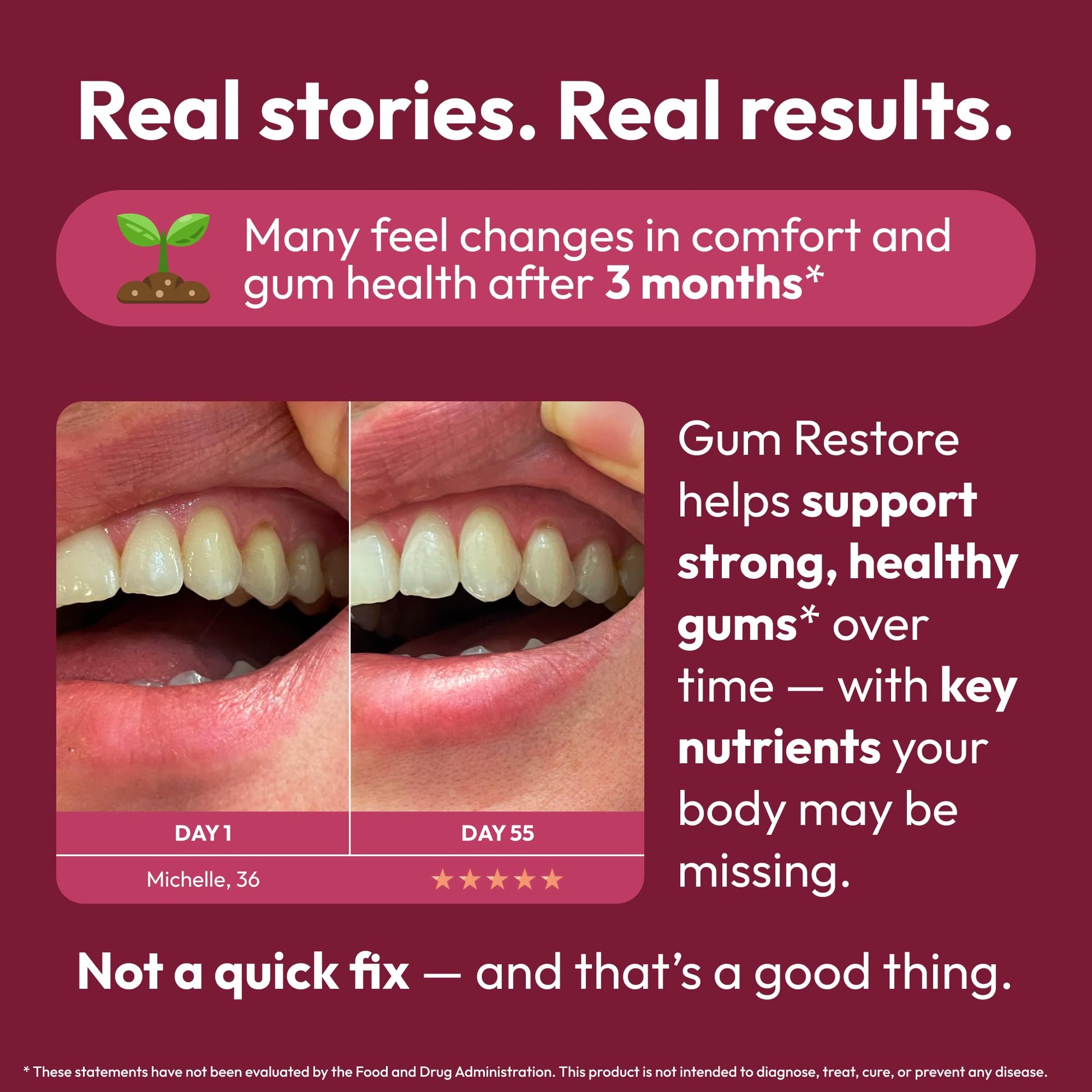 Strong Jaw Gum Restore - Gum Repair for Receding Gums | Teeth Magnesium Supplements, Oral Care, Remineralizing Dental Health Vitamins for Adults | 1 Month Supply, 180 Capsules, Made in USA Strong Jaw buy supplements canada