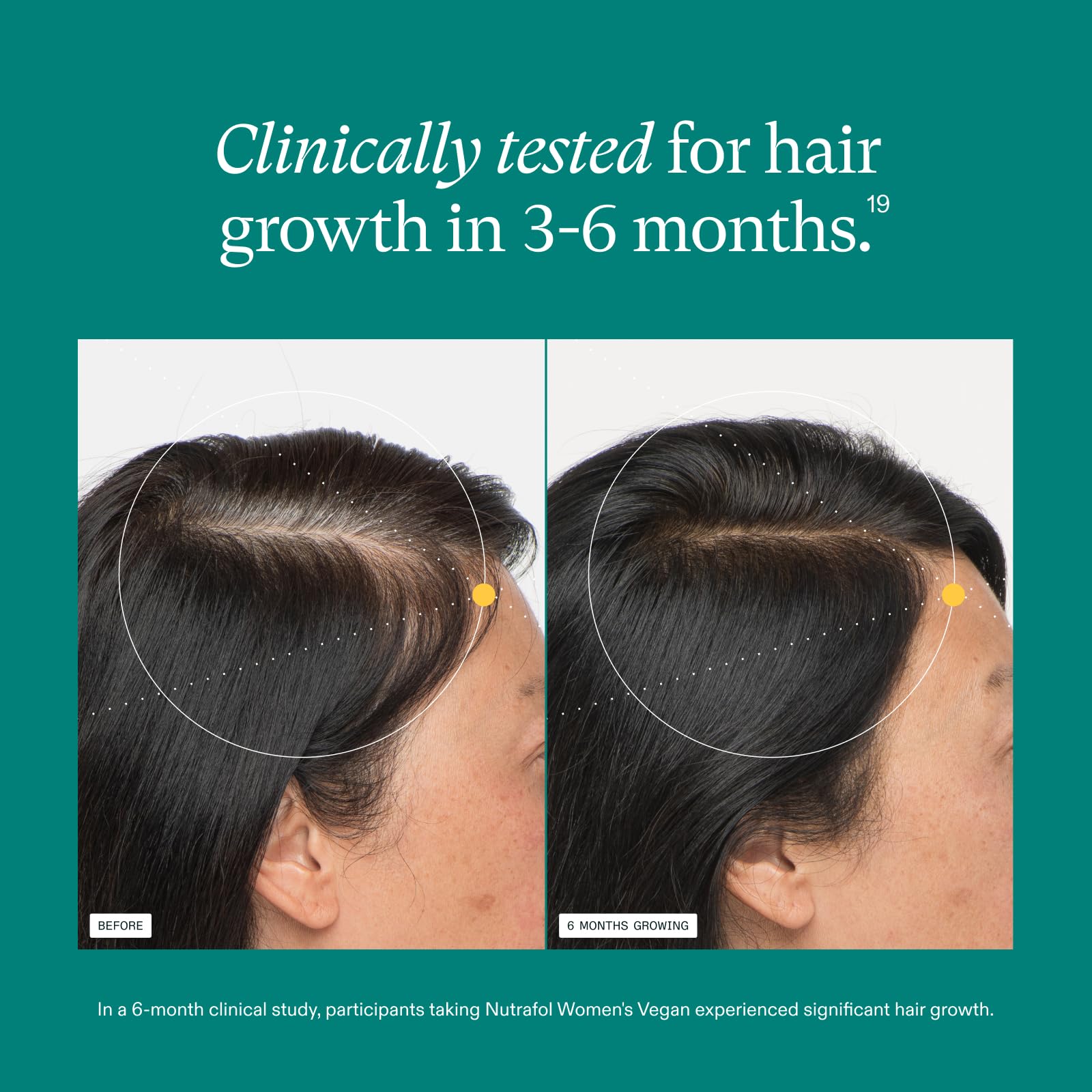 Nutrafol Women's Hair Growth Supplements, For Women 18-44 Years Old, Clinically Tested for Visibly Thicker, Stronger Hair, 100% Vegan Ingredients,