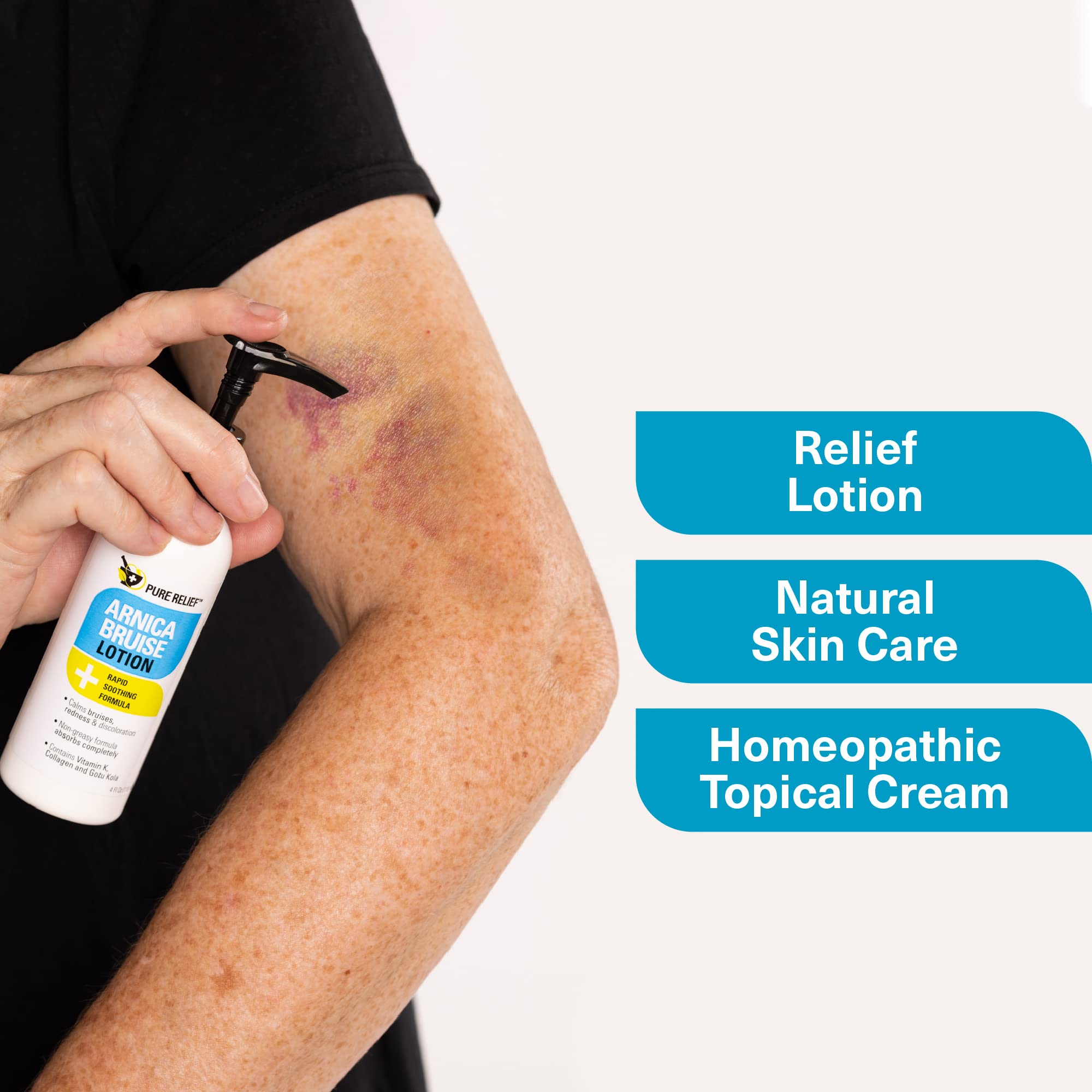 Pure Relief Arnica Bruise Relief Lotion for Bruising, Swelling, & Discoloration On Skin, Natural Skin Care Arnica Bruise Homeopathic Topical Bruise Cream W/Aloe Vera & Collagen, 4 Fl Oz (Pack of 3) Pure Relief buy supplements canada