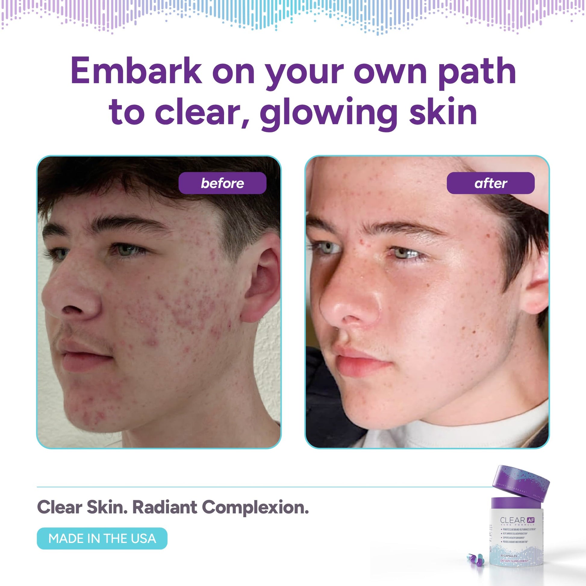 Clear AF Clear Skin Supplement | Skin Barrier Hydration & Clear Complexion Support with Vegan Ceramides, Zinc, Vitamin D3, B6, Riboflavin & Thiamine | Vegan Capsules | 30-Day Supply Clear AF buy supplements canada