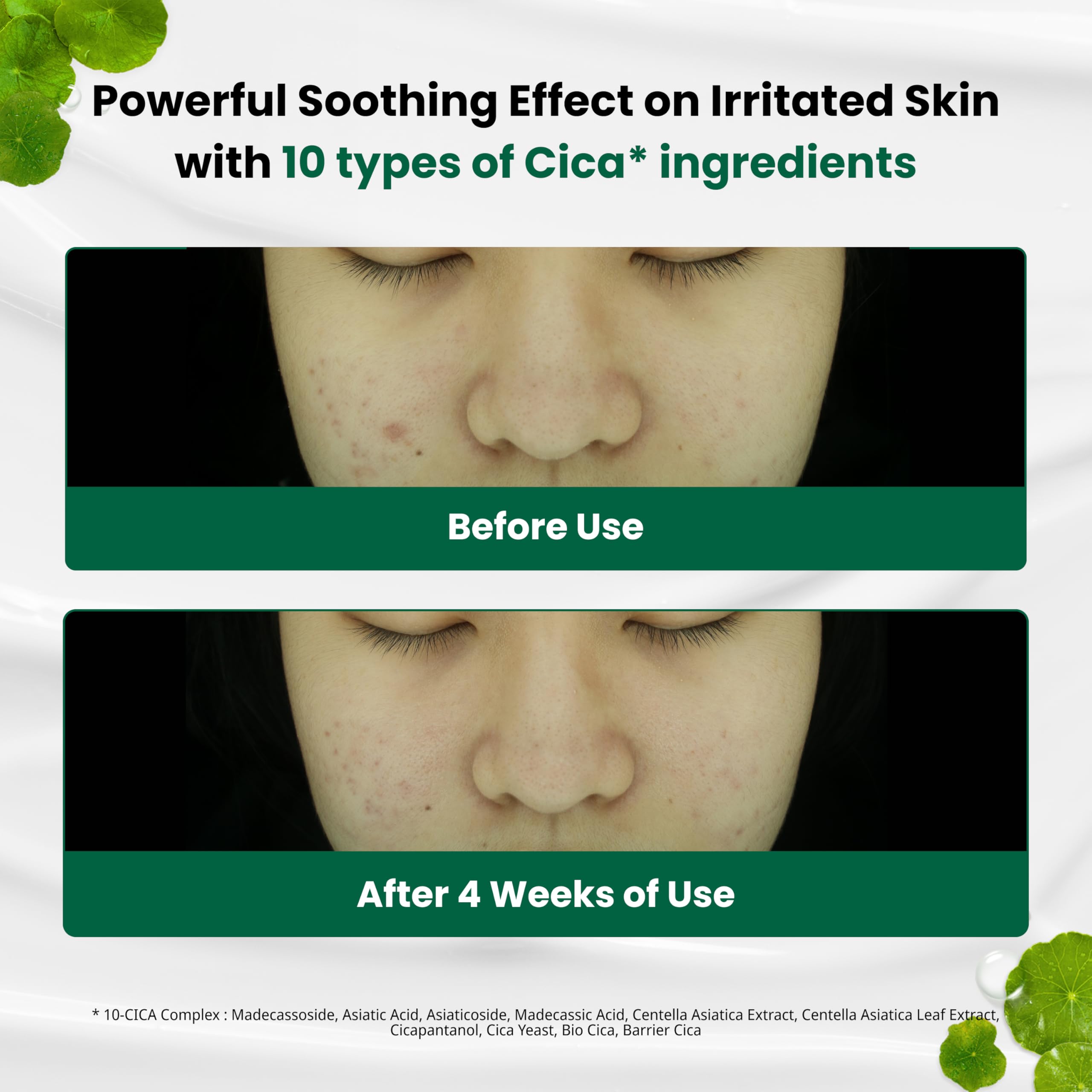 Dr. G R.E.D. Blemish Clear Soothing Cream - Calming Korean Moisturizer for Redness - Soothes Acne & Irritation Dr.G buy supplements canada