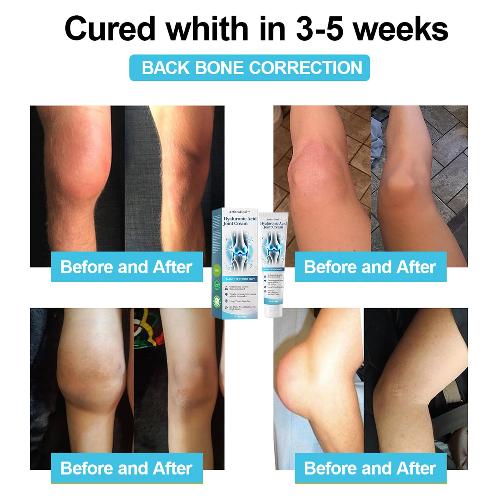 Luhaka ArthroHeal Hyaluronic Acid Joint R-epair Cream,ArthroHeal Joint Cream,Quickly relieve joint discomfort, Quickly relieve joint discomfort, suitable for joint activities throughout the body (1) Luhaka buy supplements canada
