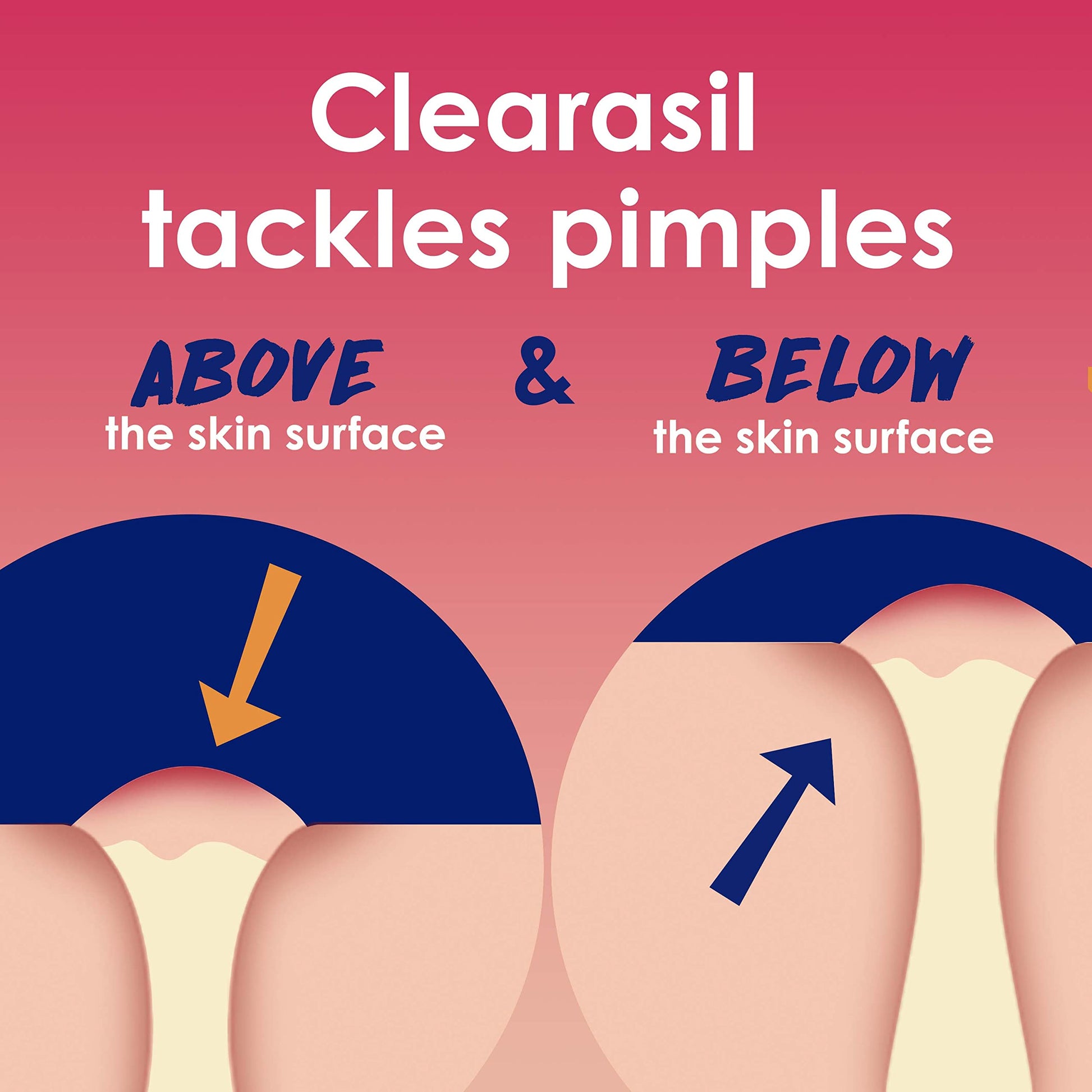 Clearasil Rapid Rescue Deep Treatment Acne Face Pads, Maximum Strenght with 2% Salicylic Acid Acne Clearasil buy supplements canada