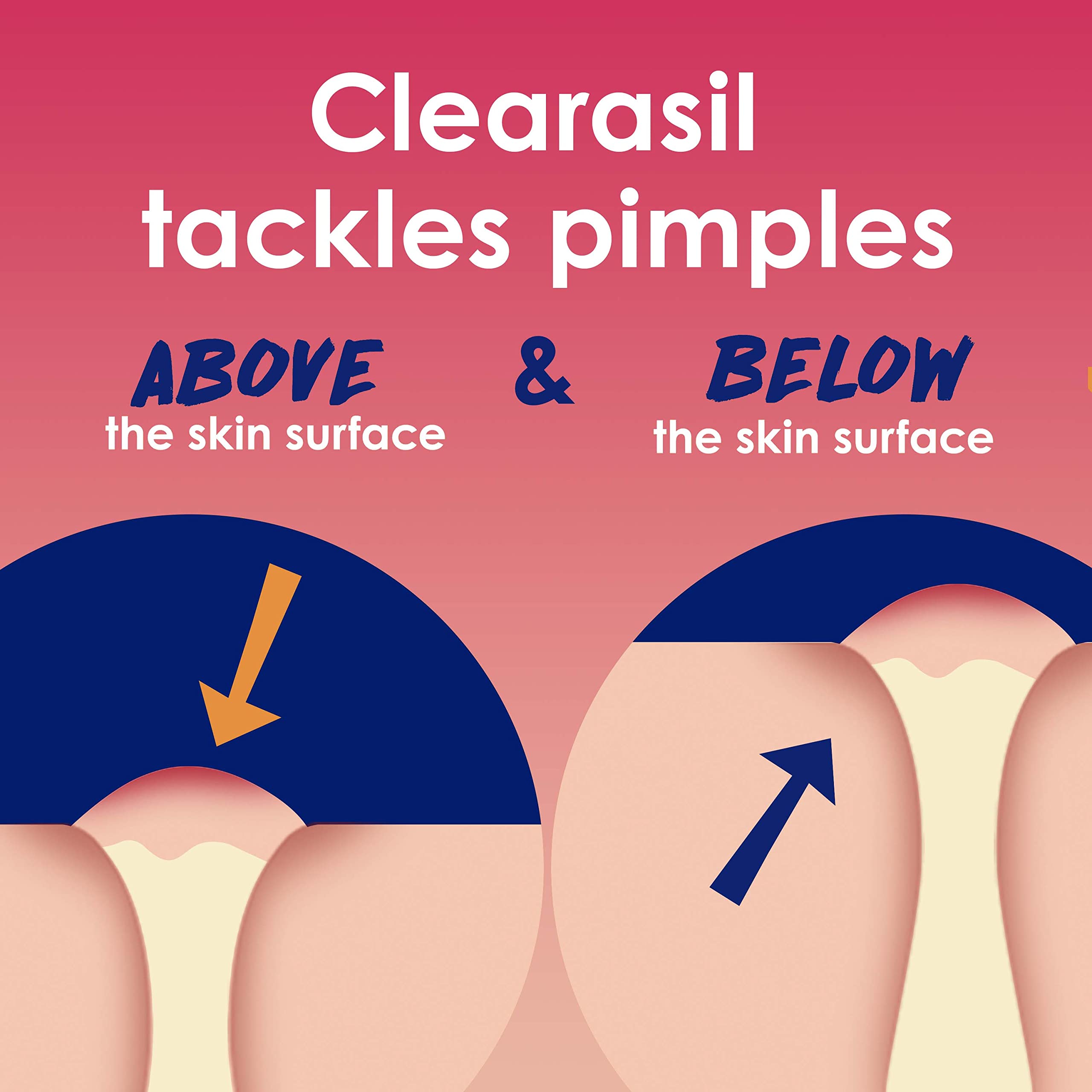 Clearasil Rapid Rescue Deep Treatment Acne Face Pads, Maximum Strenght with 2% Salicylic Acid Acne Clearasil buy supplements canada