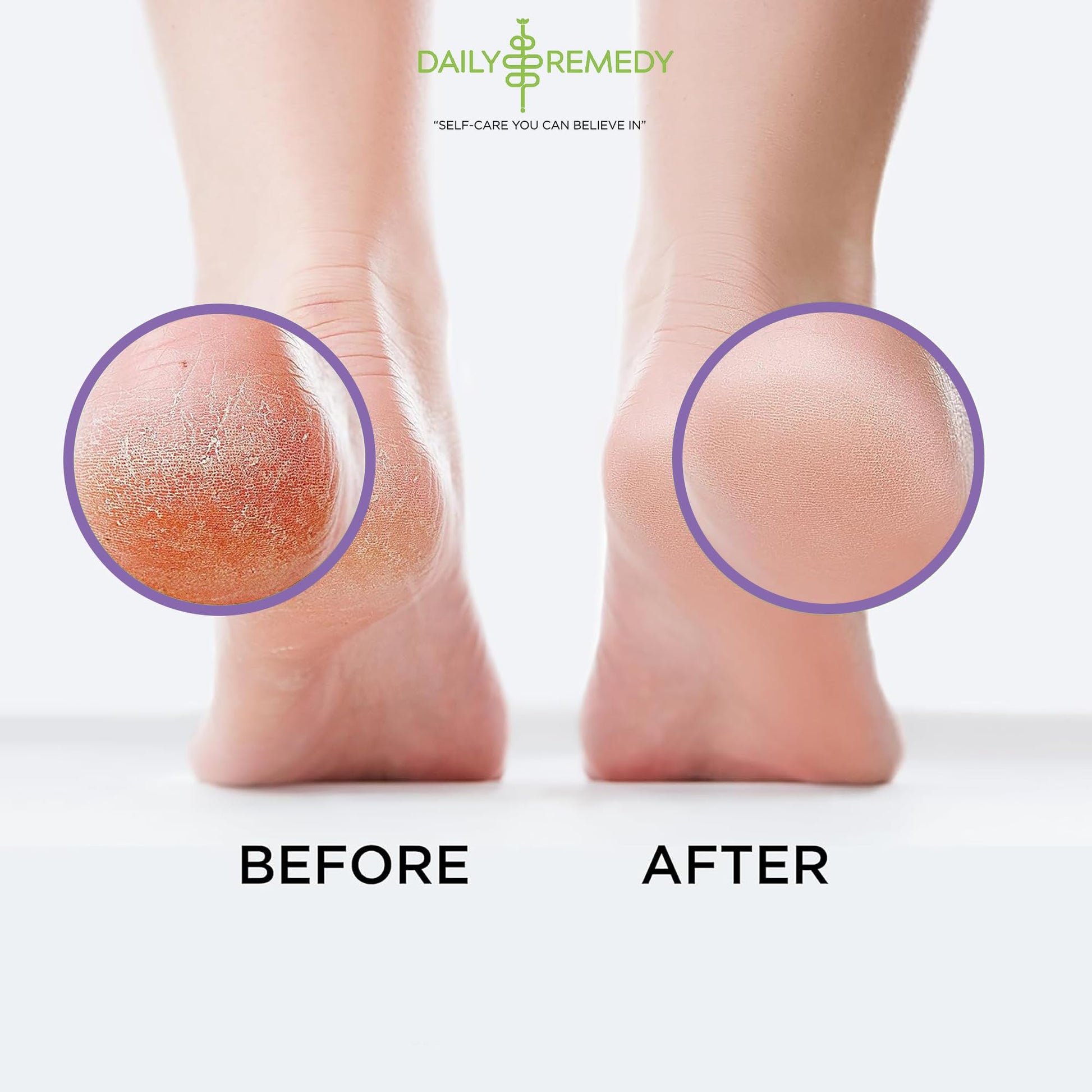 Calming Lavender Foot Soak with Epsom Salt, Made in USA, Foot Soak Soothes Sore Tired DAILY REMEDY buy supplements canada