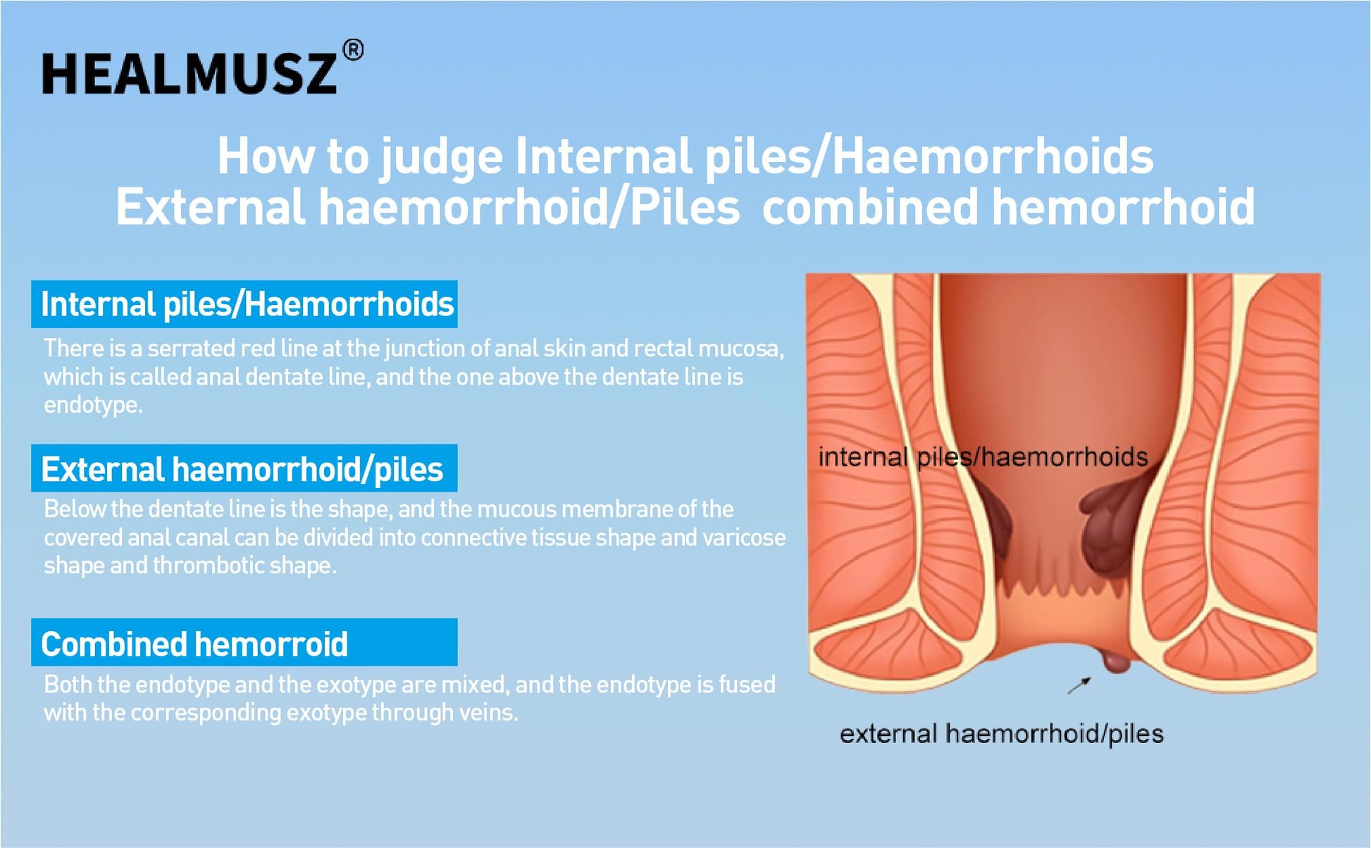 HEALMUSZ Hemorrhoid Fissure Ointment– Hemorrhoid Treatment and Hemorrhoid Cream with Lidocaine and Phenylephrine HCI for Fast Acting Relief of Pain, Swelling, Discomfort, and Itching(1.5 oz) HEALMUSZ buy supplements canada
