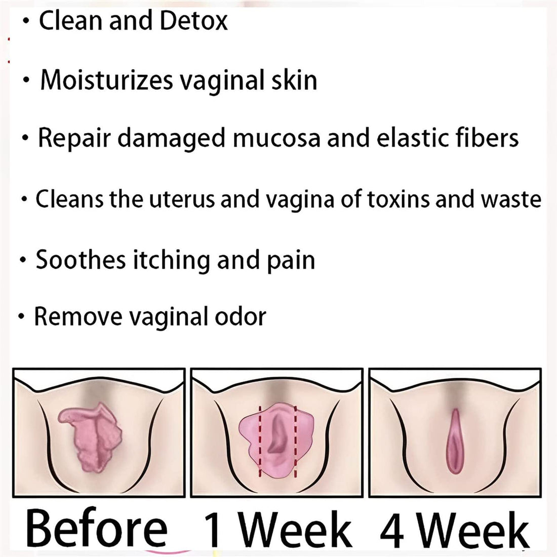AnnieCare Instant Anti-Itch Detox Slimming Products, Annie Care Natural Detox Viginal Gel DASHENRAN buy supplements canada