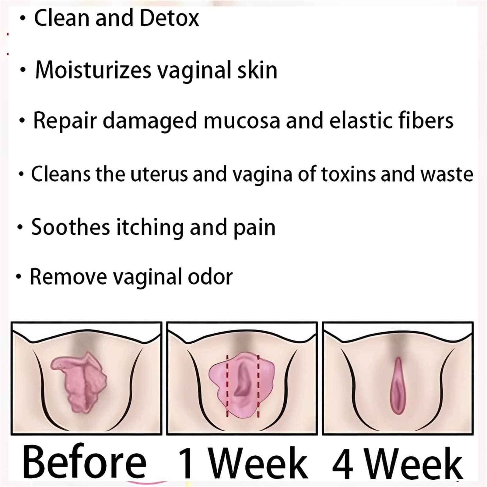 AnnieCare Instant Anti-Itch Detox Slimming Products, Annie Care Natural Detox Viginal Gel DASHENRAN buy supplements canada