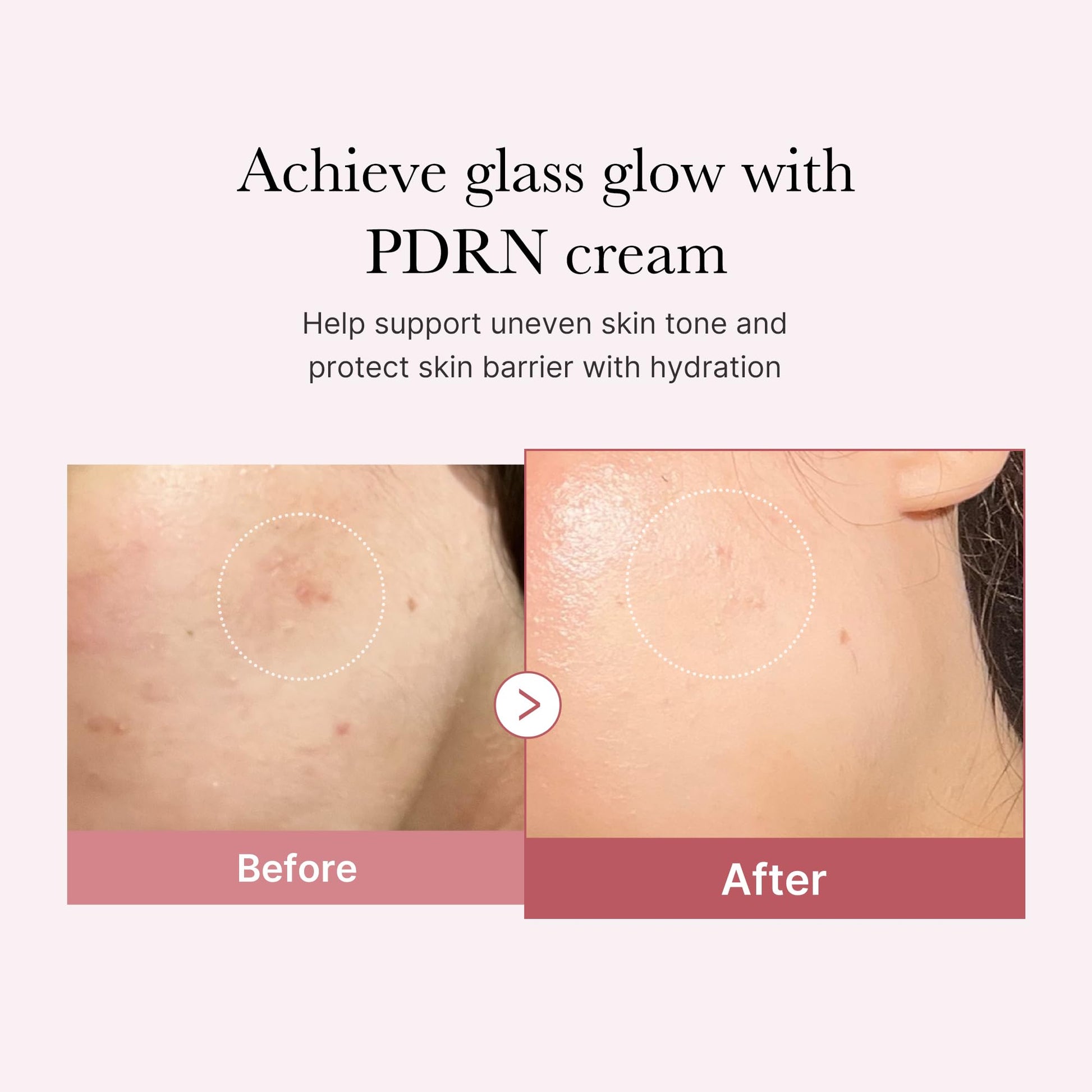 medicube PDRN Pink Hyaluronic Moisturizing Cream | Blemish Recovery, Relief & Hydrating Care | Restores Skin Elasticity & Glow medicube buy supplements canada