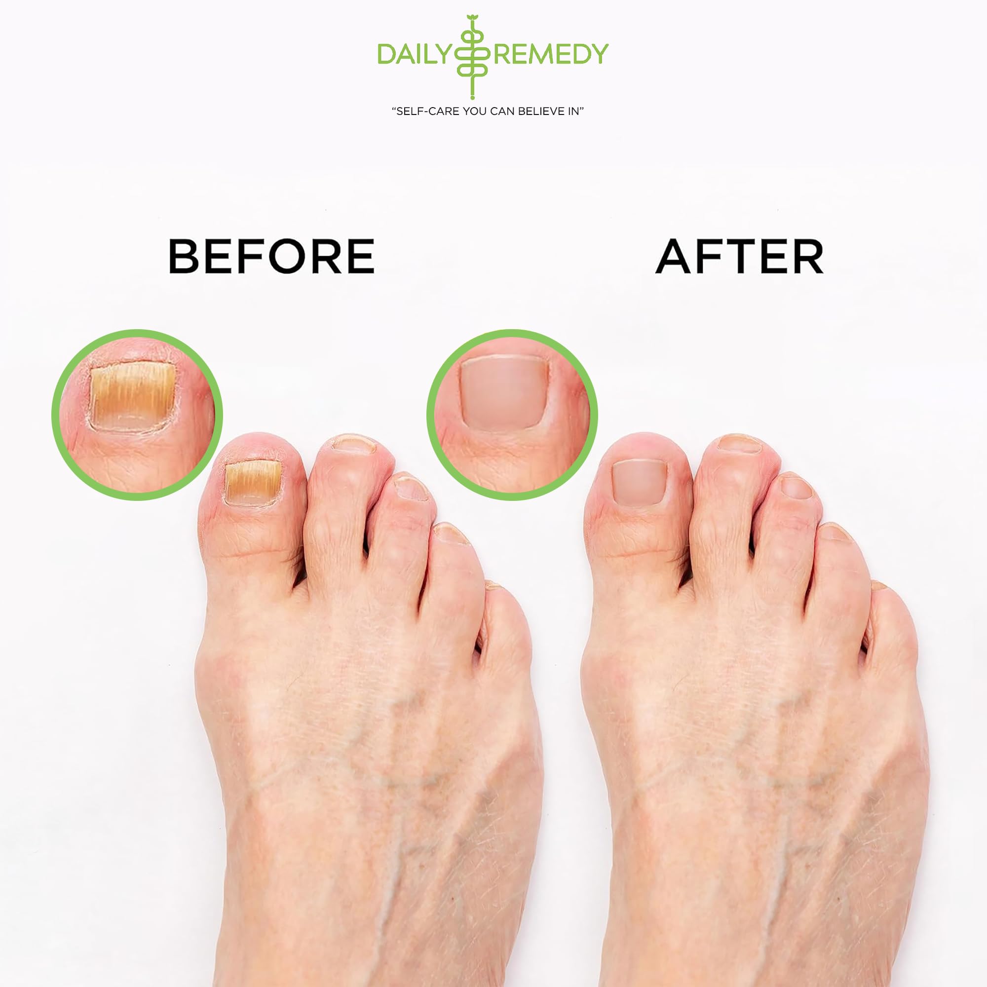 Tea Tree Oil Foot Soak with Epsom Salt - Made in USA - for Toenail Athletes Foot DAILY REMEDY buy supplements canada