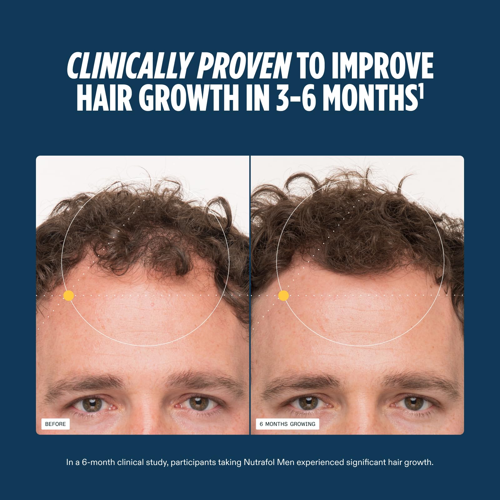 Nutrafol Men's Hair Growth Supplements, Clinically Tested for Visibly Thicker Hair and Scalp Coverage, Dermatologist Recommended - 1 Month Supply Nutrafol buy supplements canada