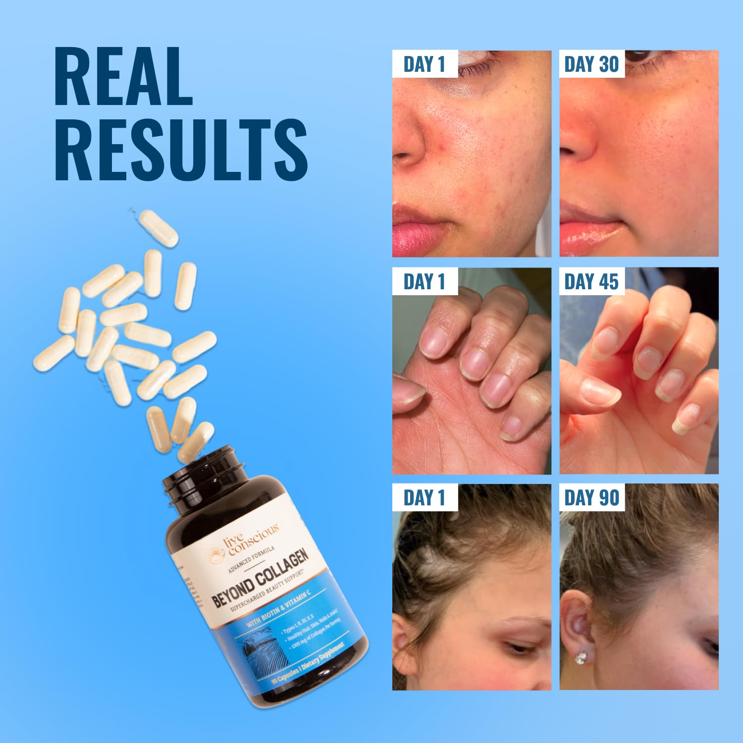Live Conscious Beyond Collagen Multi Collagen Capsules - Types I, II, III, V & X - Hydrolyzed Blend with Biotin & Vitamin C Live Conscious buy supplements canada