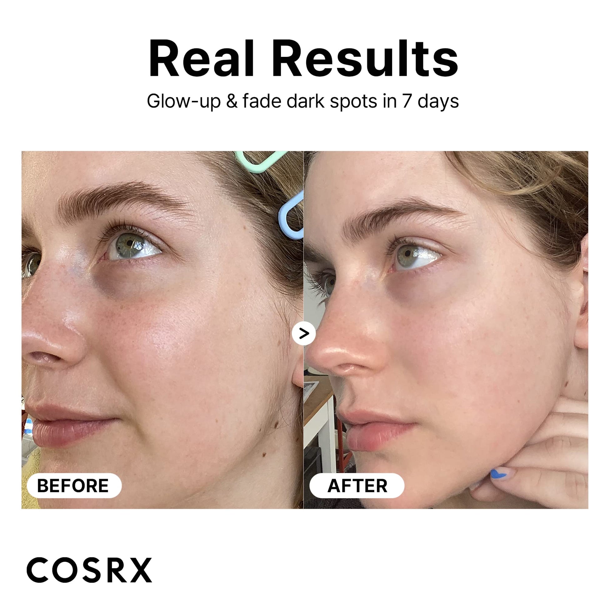 COSRX Pure Vitamin C Serum with Vitamin E & Hyaluronic Acid, Brightening COSRX buy supplements canada