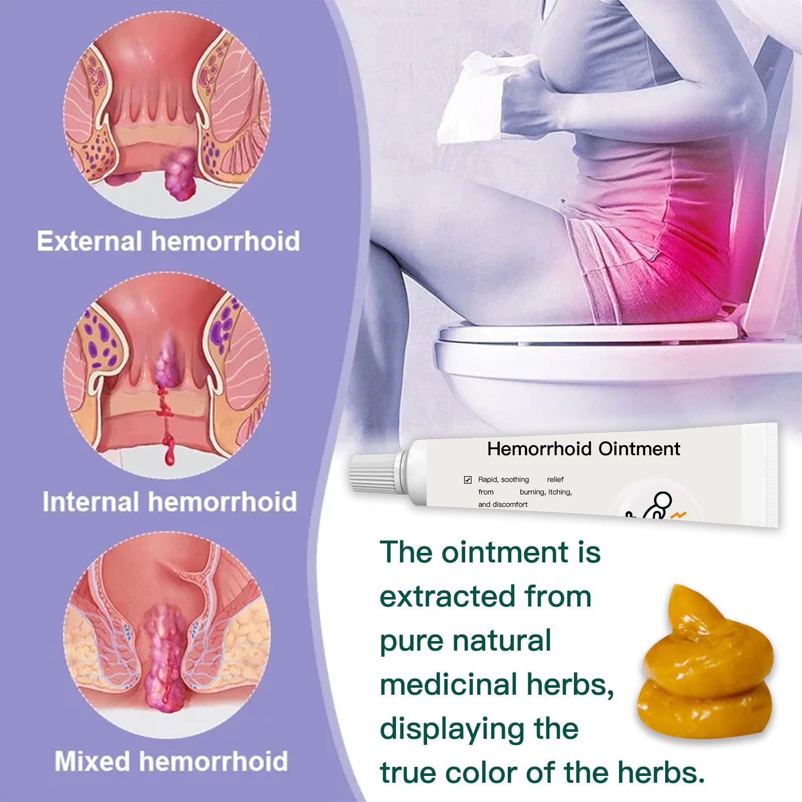 BXQJRJ Hemorrhoid Ointment,Herbal hemorrhoid Gel,Effectively relieves Anal discomfort,Suitable for Men and Women,Fast-Acting hemorrhoid Ointment (20g) BXQJRJ buy supplements canada