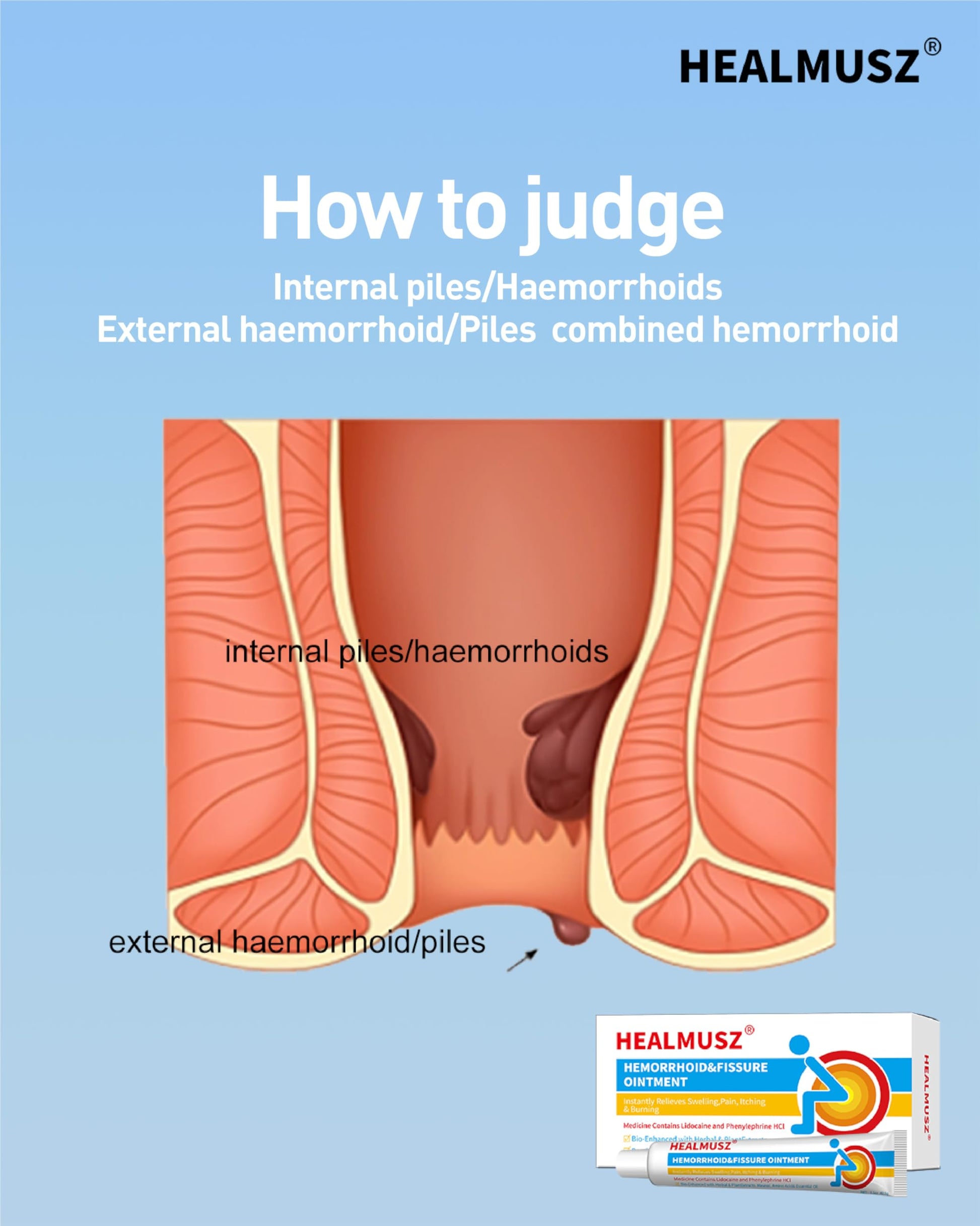HEALMUSZ Hemorrhoid Fissure Ointment– Hemorrhoid Treatment and Hemorrhoid Cream with Lidocaine and Phenylephrine HCI for Fast Acting Relief of Pain, Swelling, Discomfort, and Itching(1.5 oz) HEALMUSZ buy supplements canada