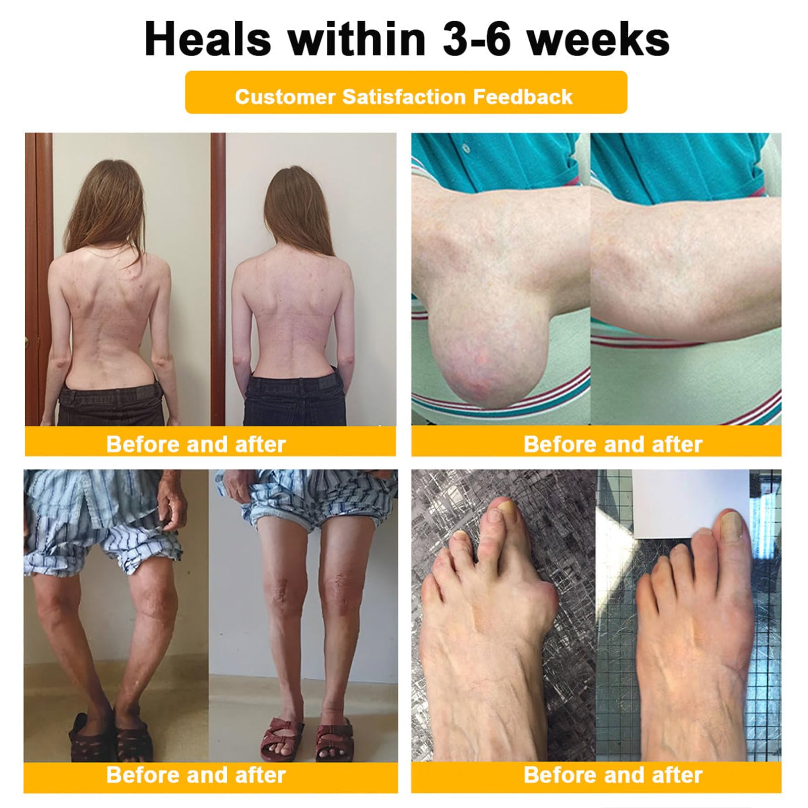 Luhaka Botulinum Toxin & Bee Venom Pain-Relief Bone Healing Cream,Bee Venom Cream,Effectively improve joint mobility (1PC) Luhaka buy supplements canada